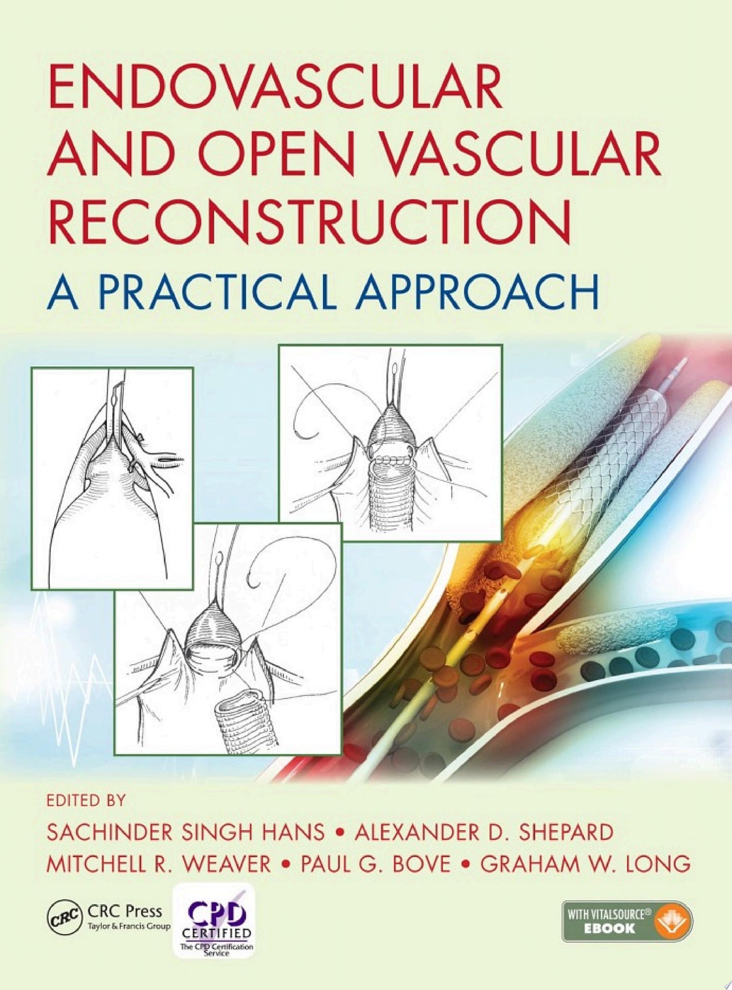 Endovascular and Open Vascular Reconstruction: A Practical Approach
