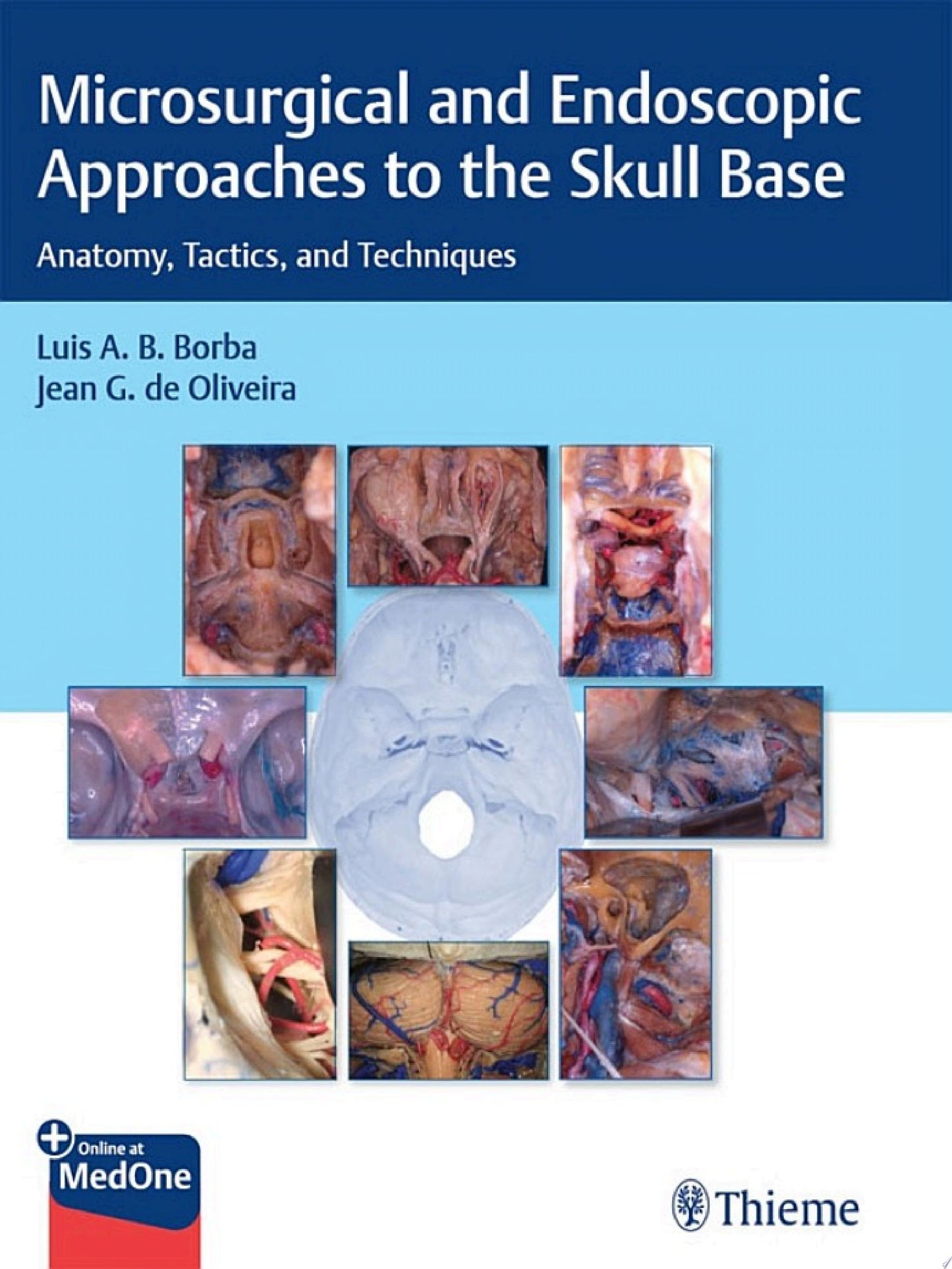 Microsurgical and Endoscopic Approaches to the Skull Base: Anatomy, Tactics, and Techniques