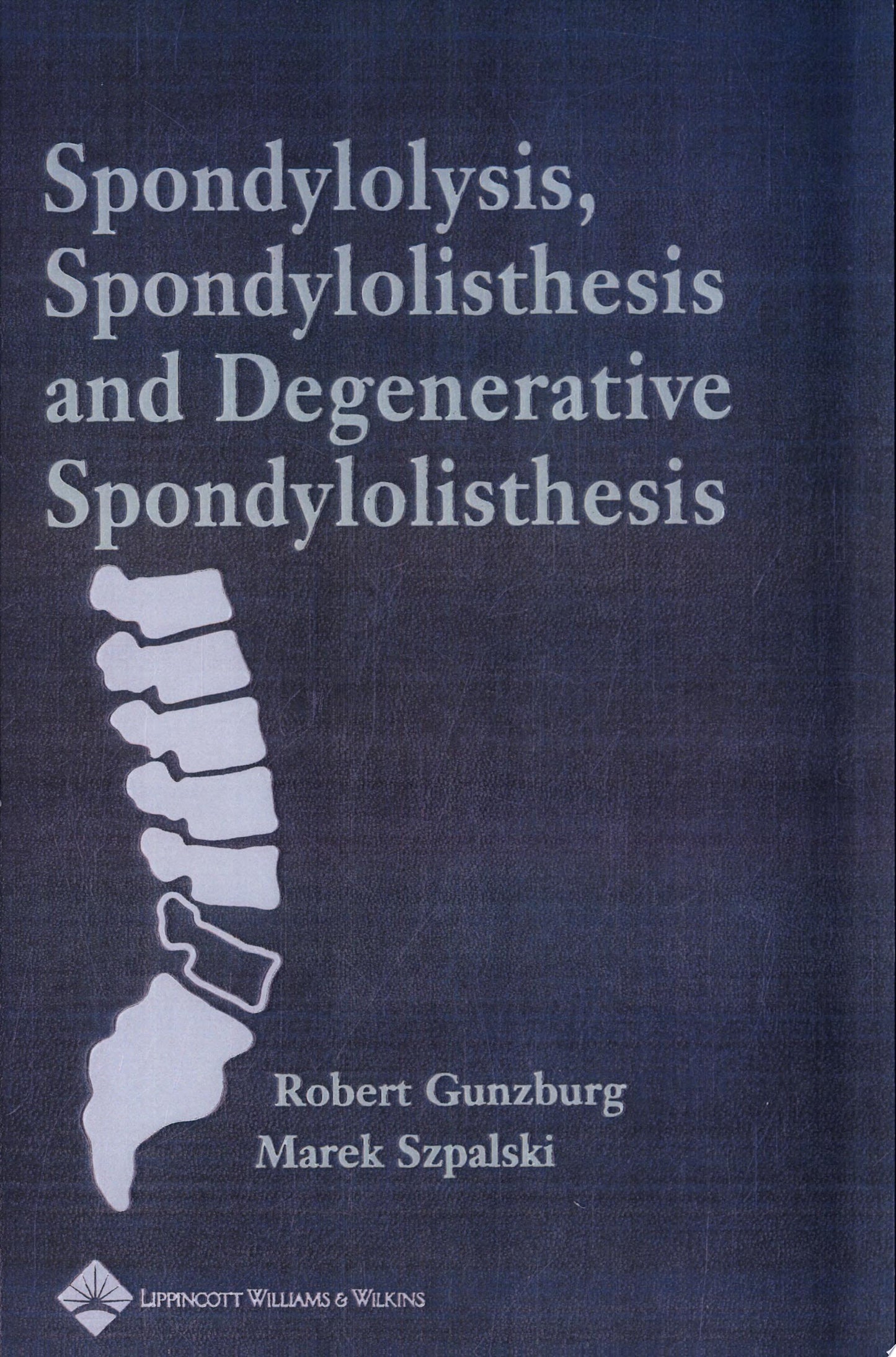 Spondylolysis, Spondylolisthesis, and Degenerative Spondylolisthesis
