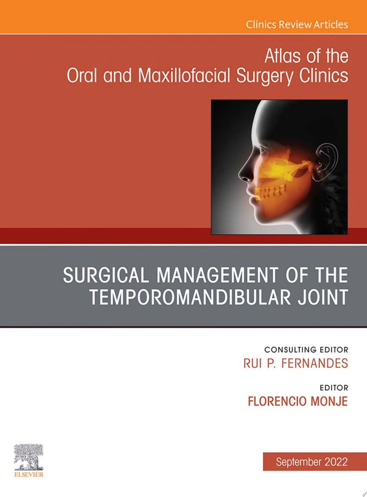 Temporomandibular Joint Surgery, An Issue of Atlas of the Oral & Maxillofacial Surgery Clinics