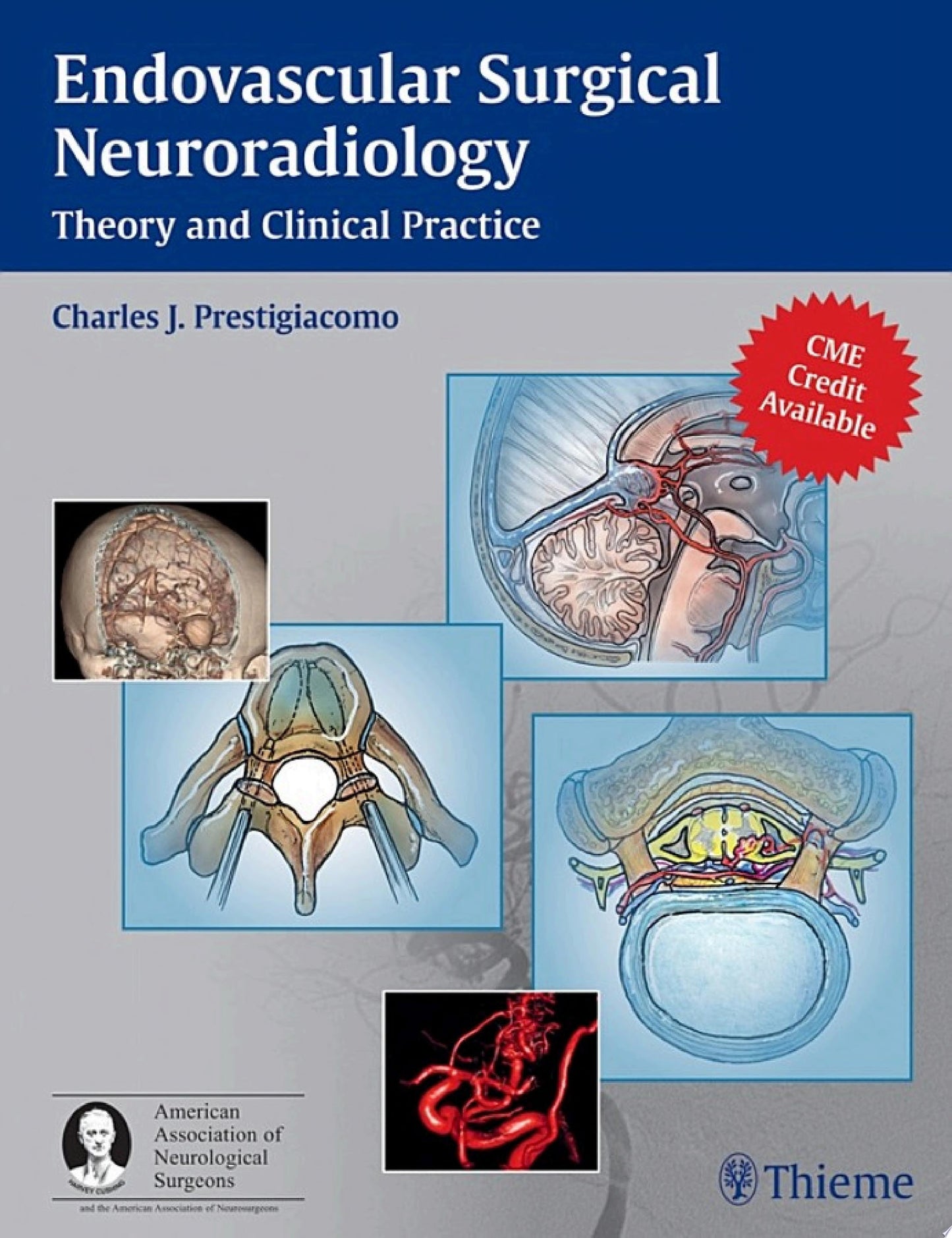 Endovascular Surgical Neuroradiology: Theory and Clinical Practice