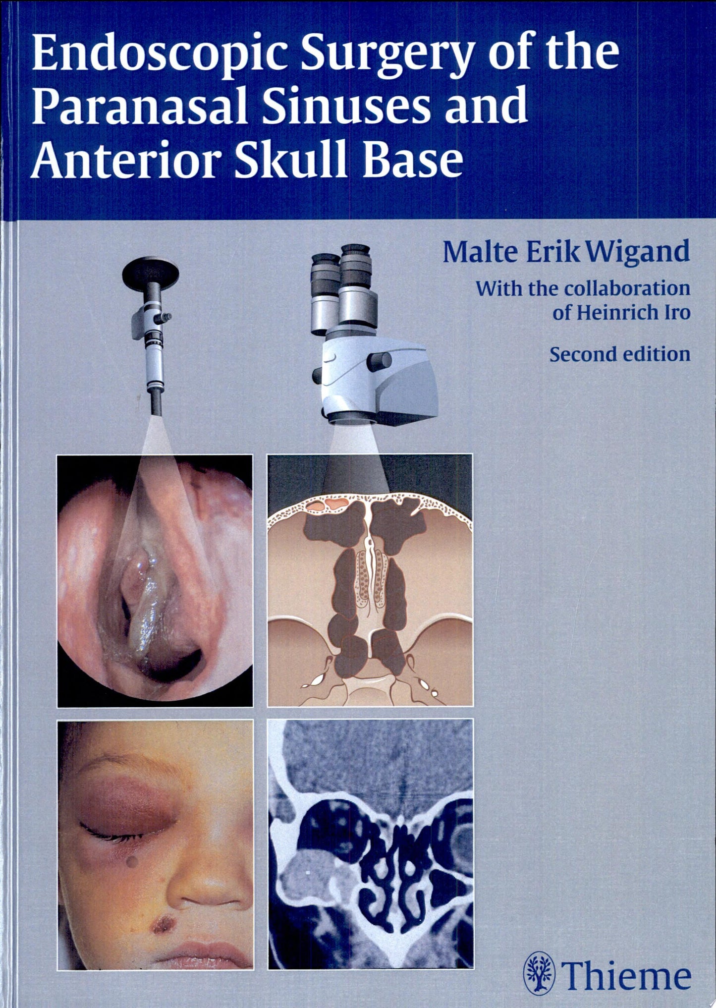 Endoscopic Surgery of the Paranasal Sinuses and Anterior Skull Base, 2nd Edition