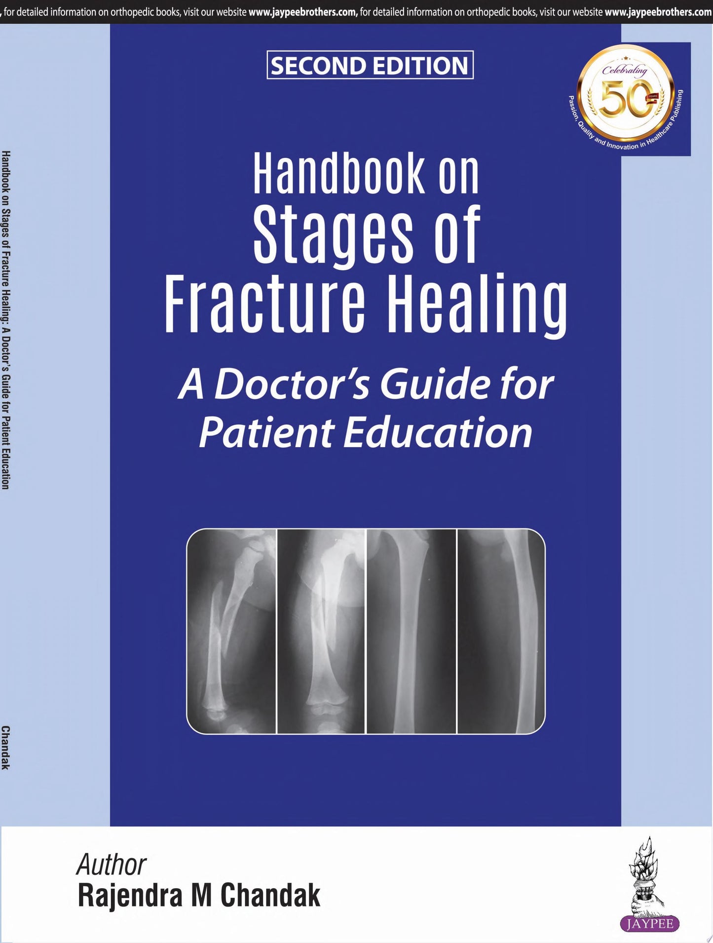 Handbook on Stages of Fracture Healing: A Doctor’s Guide for Patient Education, 2nd Edition