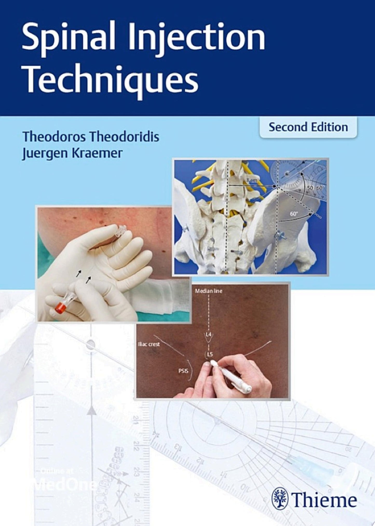 Spinal Injection Techniques, 2nd Edition