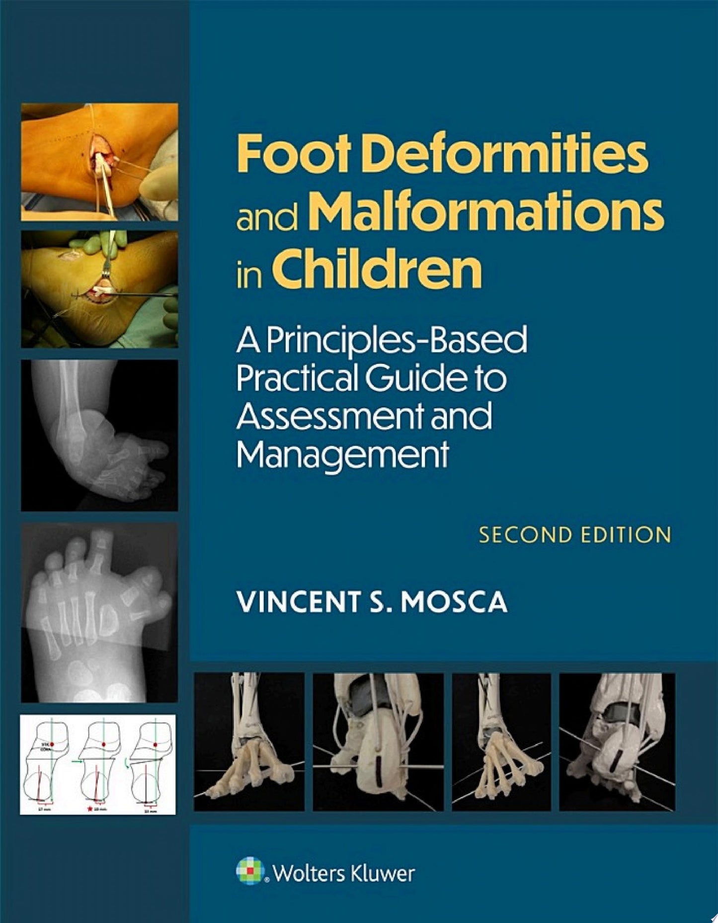 Foot Deformities and Malformations in Children: A Principles-Based, Practical Guide to Assessment and Management, 2nd edition
