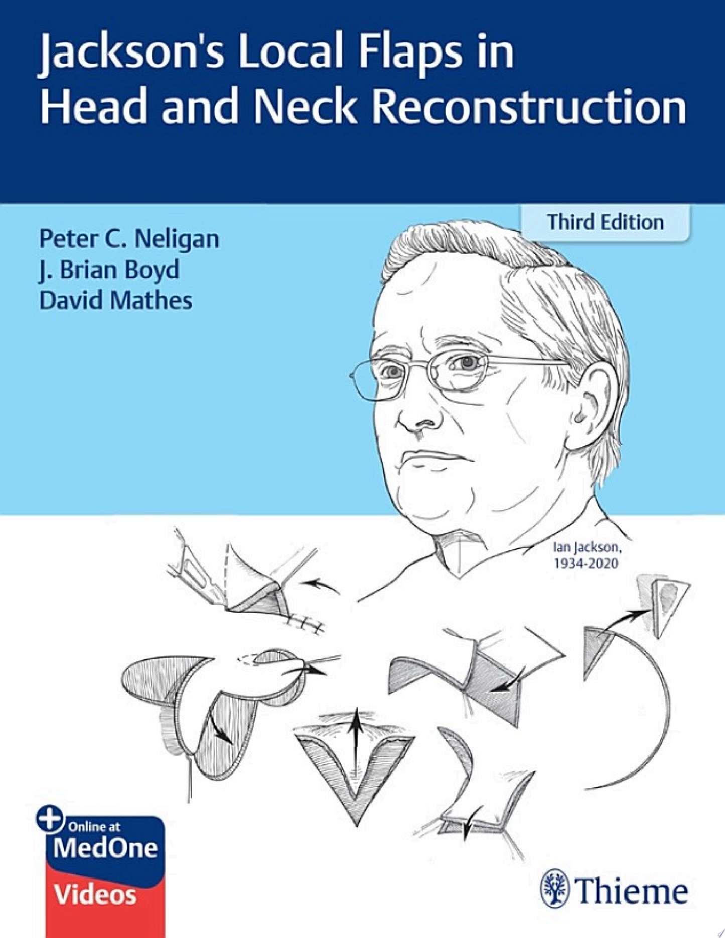 Jackson’s Local Flaps in Head and Neck Reconstruction