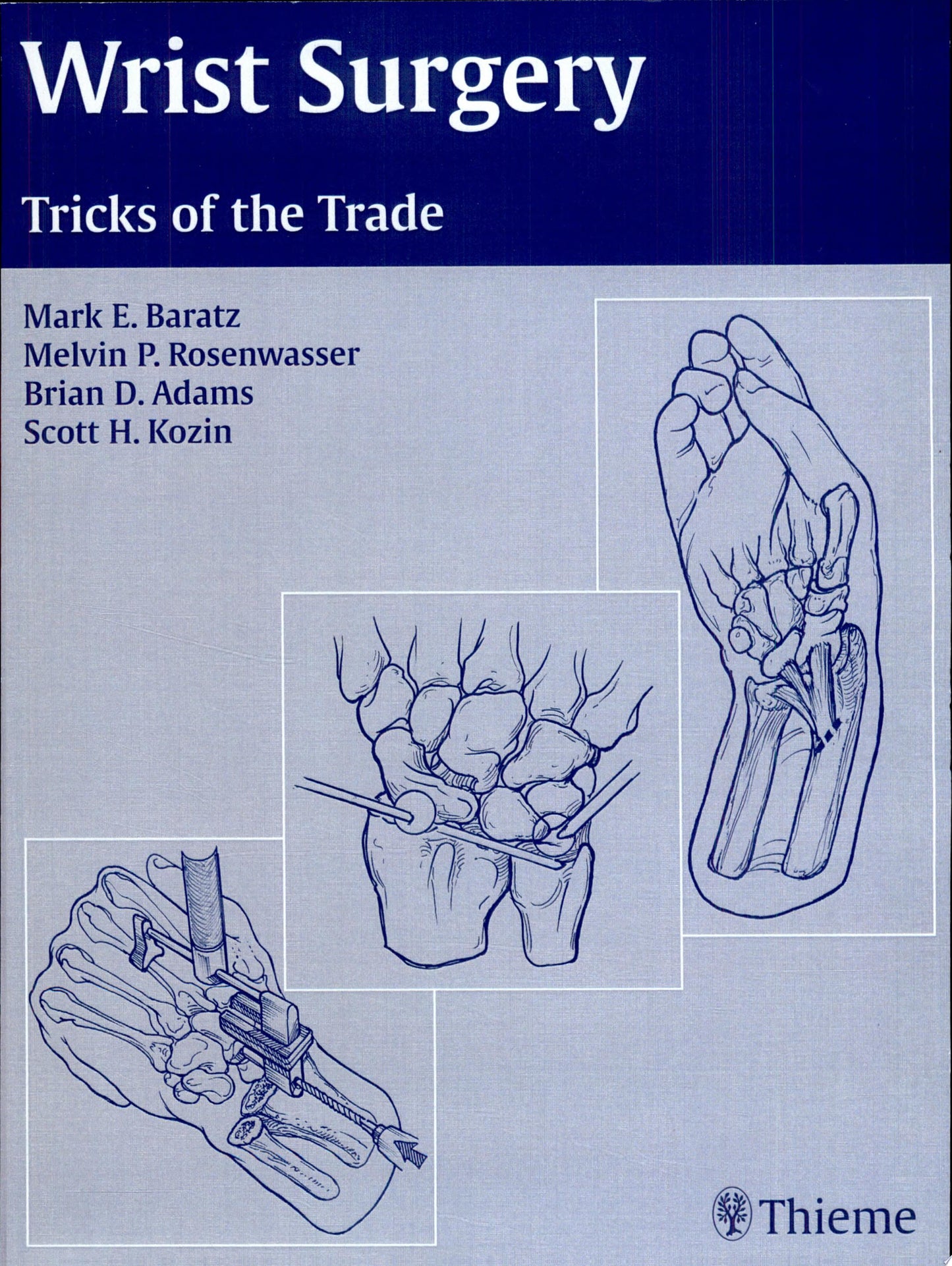 Wrist Surgery Tricks of the Trade