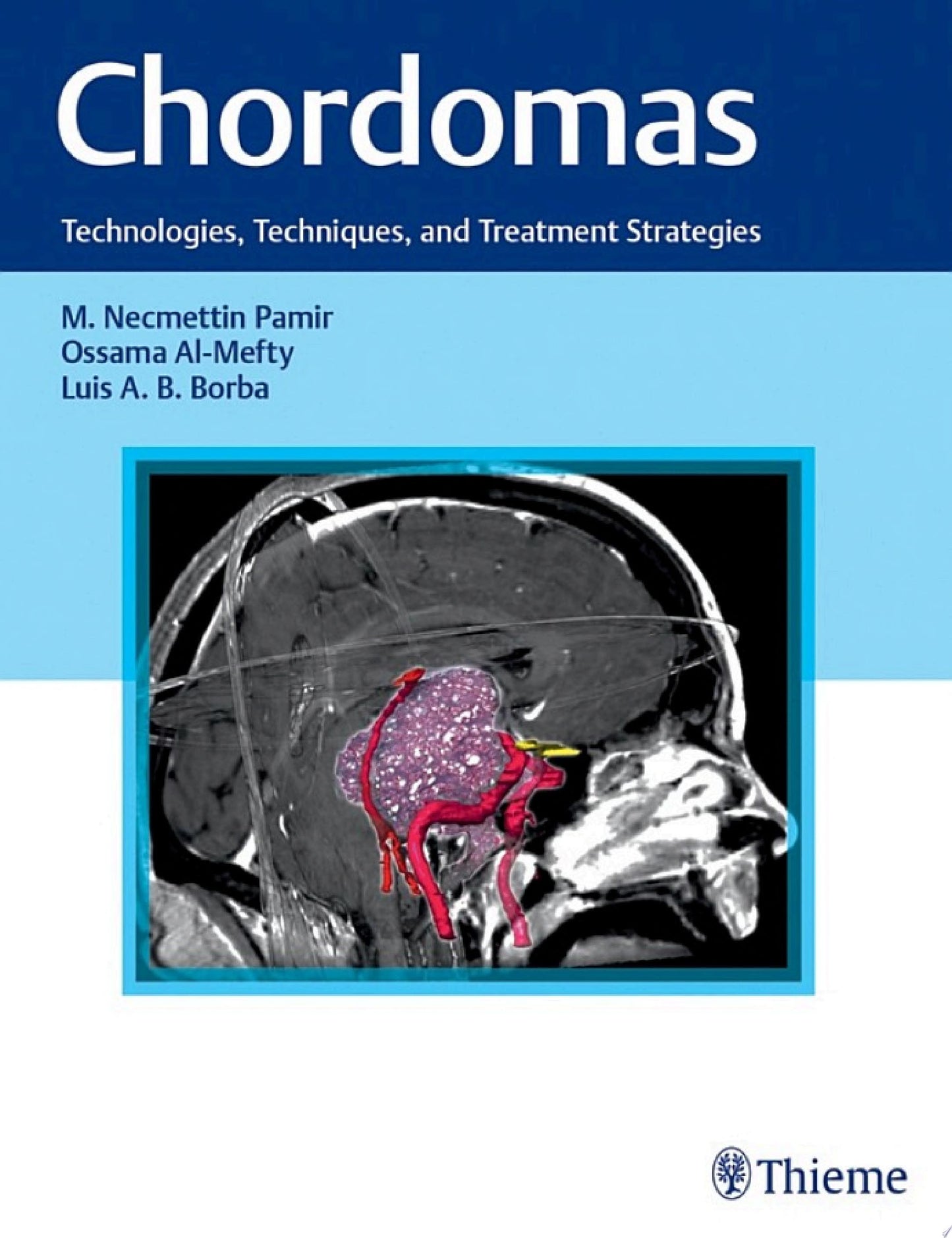 Chordomas: Technologies, Techniques, and Treatment Strategies