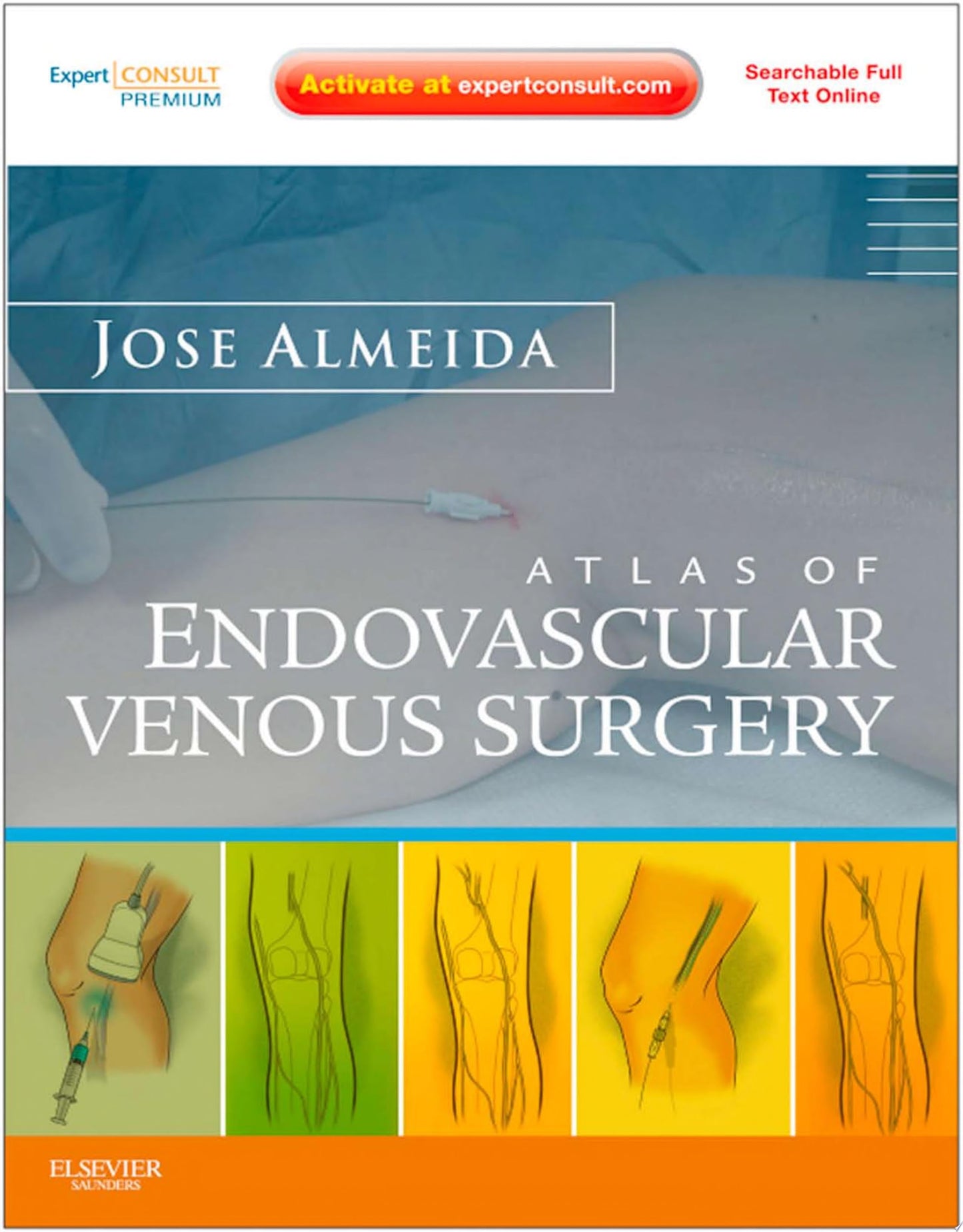 Atlas of Endovascular Venous Surgery: Expert Consult – Online and Print