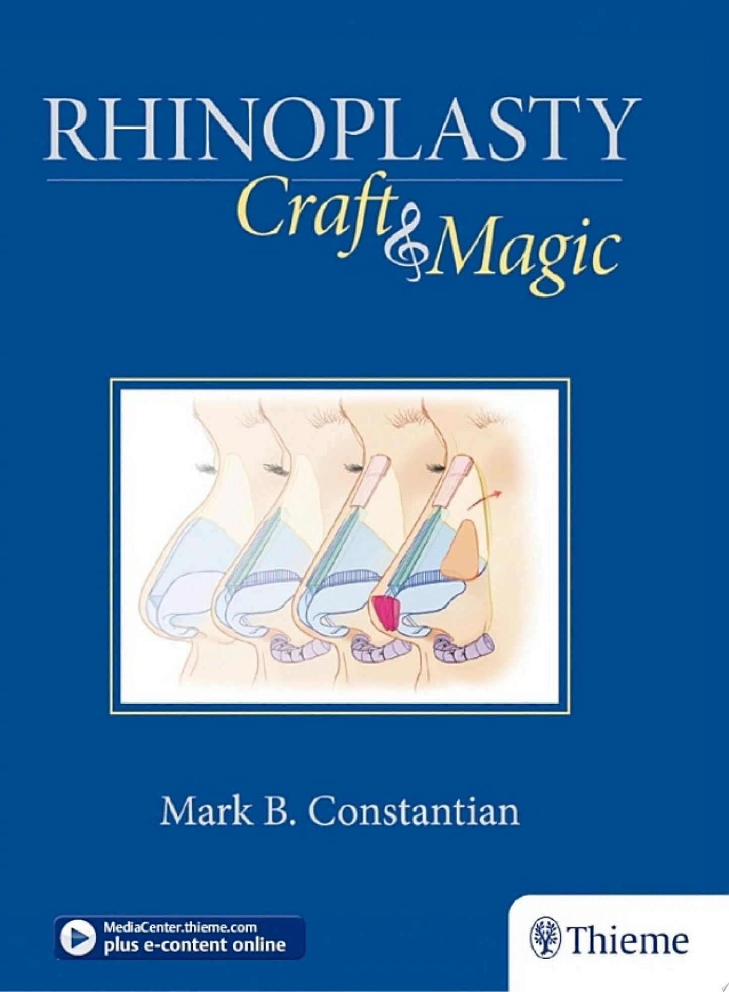 Rhinoplasty: Craft and Magic, 1ed