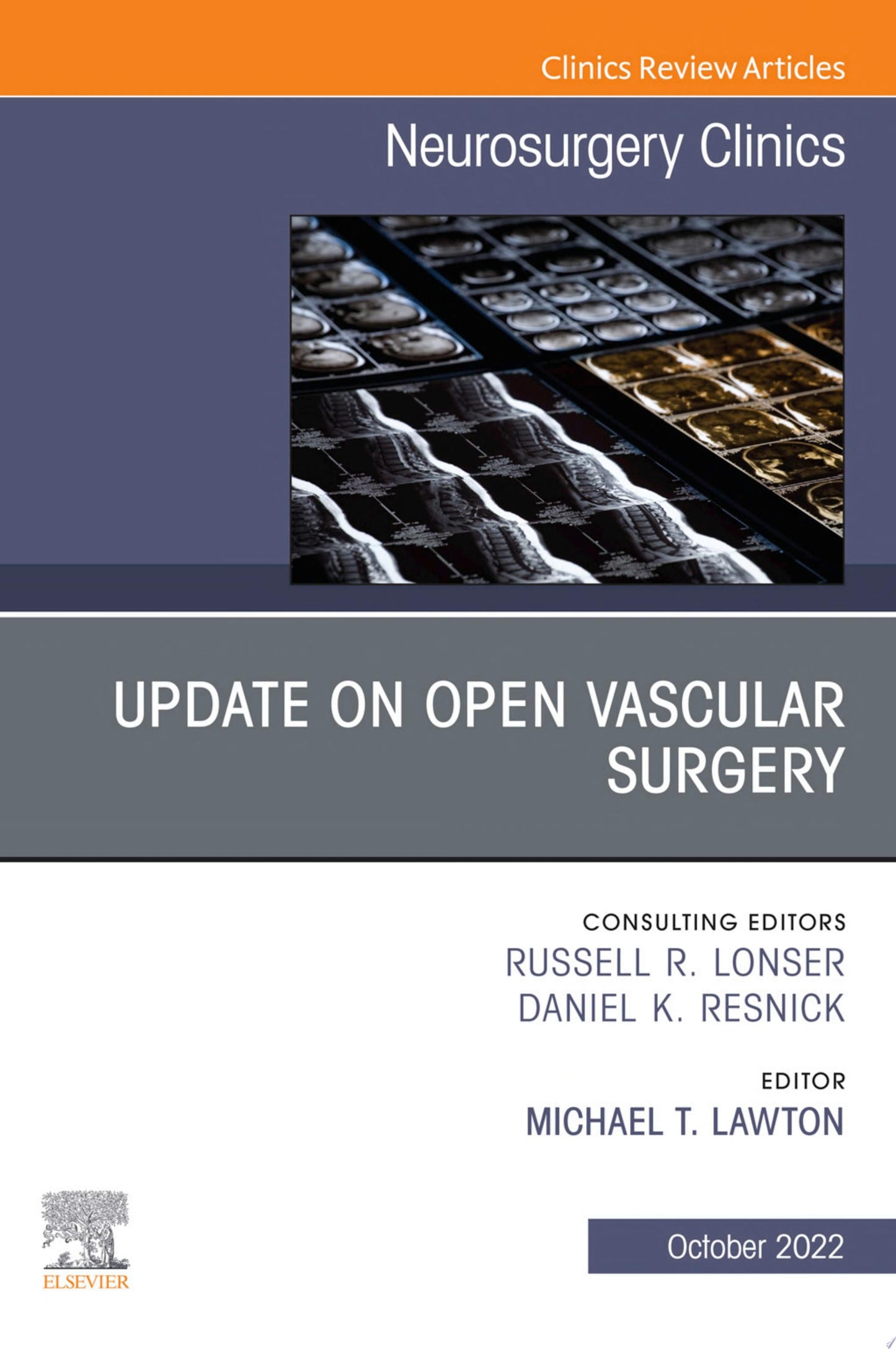 Update on Open Vascular Surgery, An Issue of Neurosurgery Clinics of North America