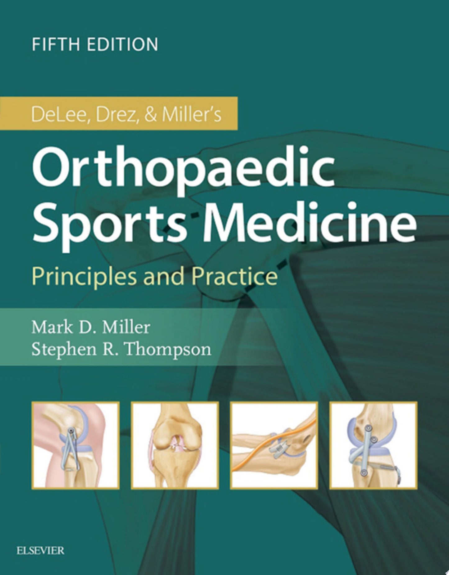 DeLee & Drez’s Orthopaedic Sports Medicine: 2-Volume Set, 4th Edition