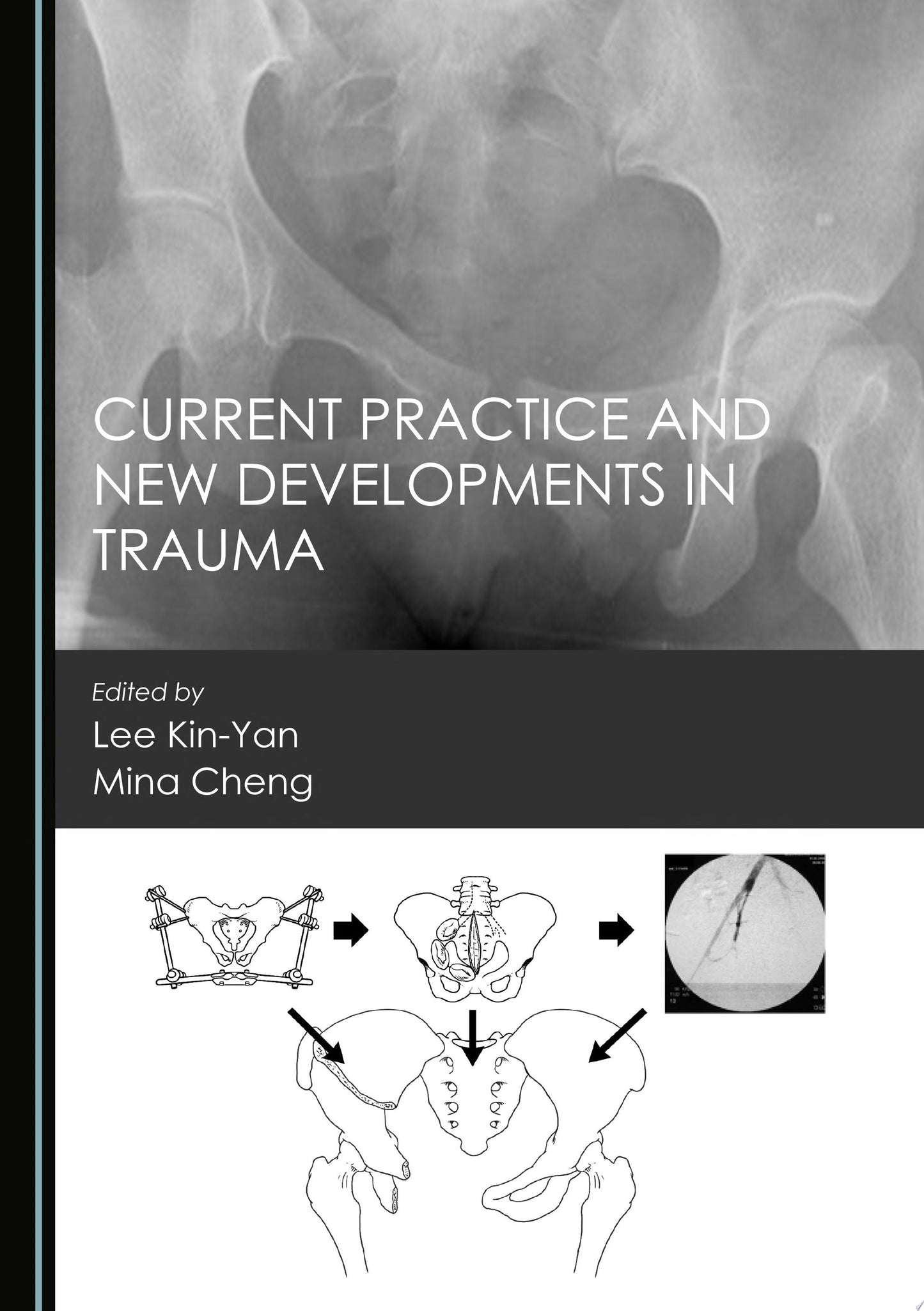 Current Practice and New Developments in Trauma