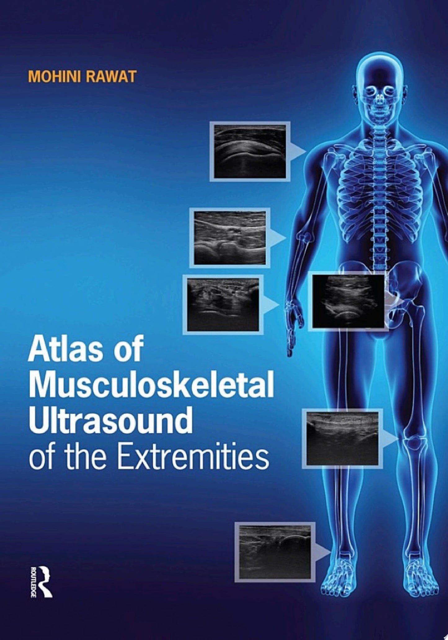 Atlas of Musculoskeletal Ultrasound of the Extremities