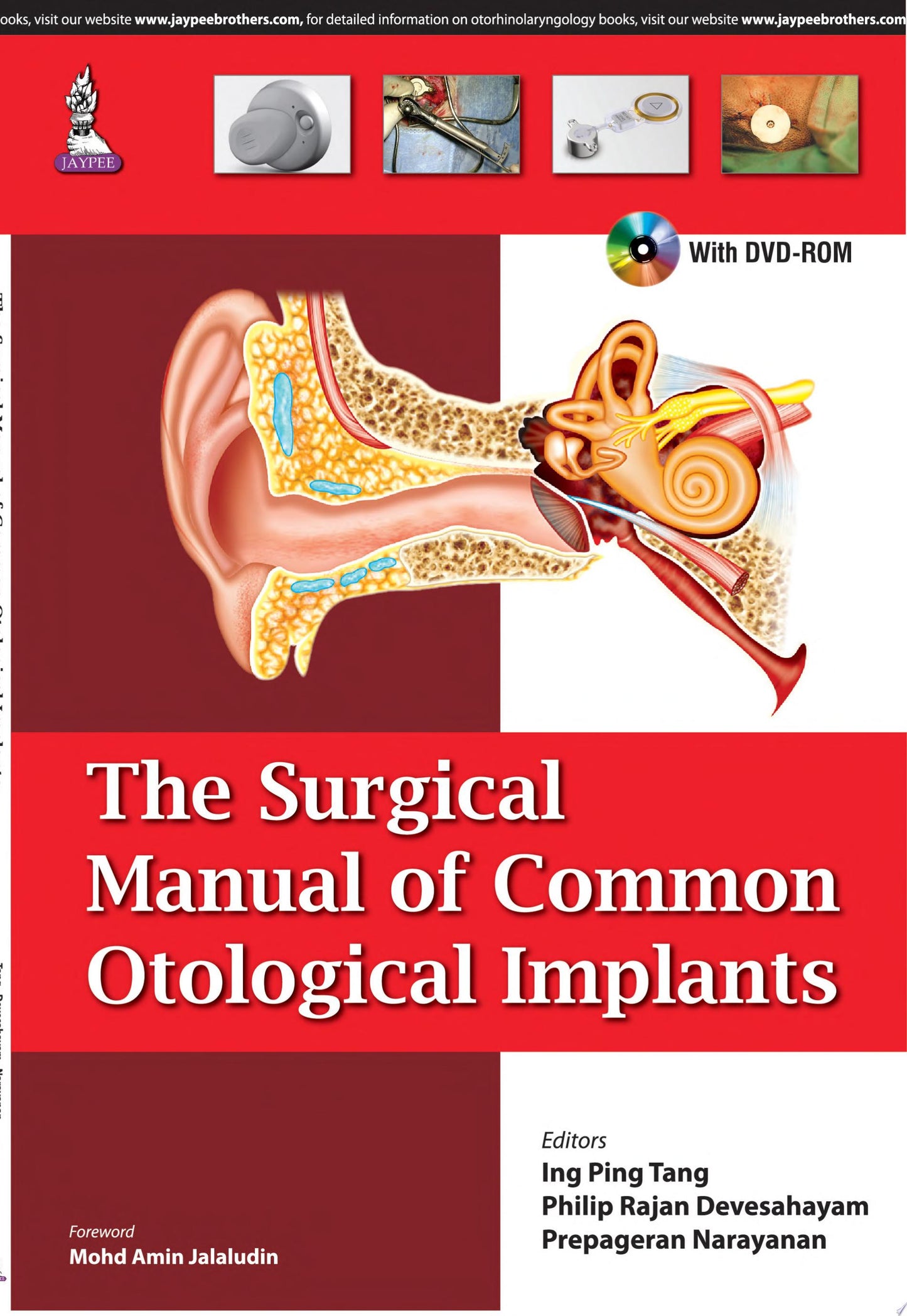 The Surgical Manual of Common Otological Implants
