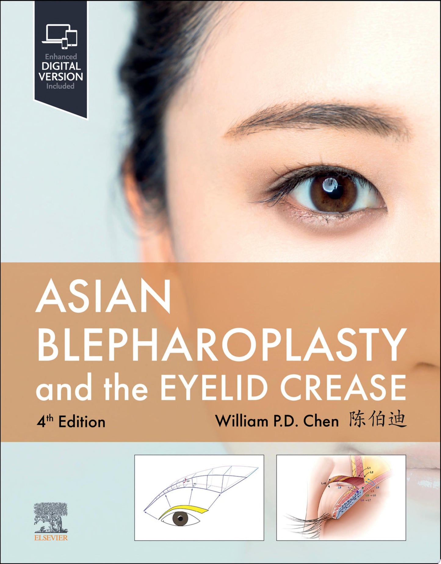 Asian Blepharoplasty and the Eyelid Crease, 4th Edition