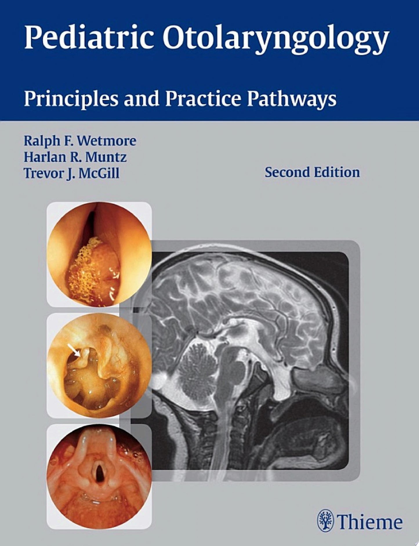 Pediatric Otolaryngology: Principles and Practice Pathways