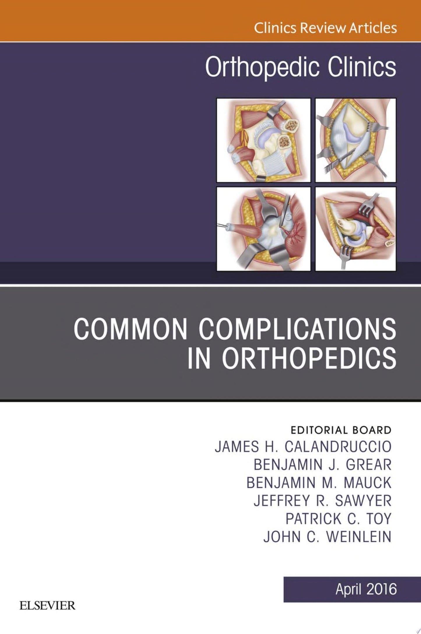 Common Complications in Orthopedics, An Issue of Orthopedic Clinics, 1e