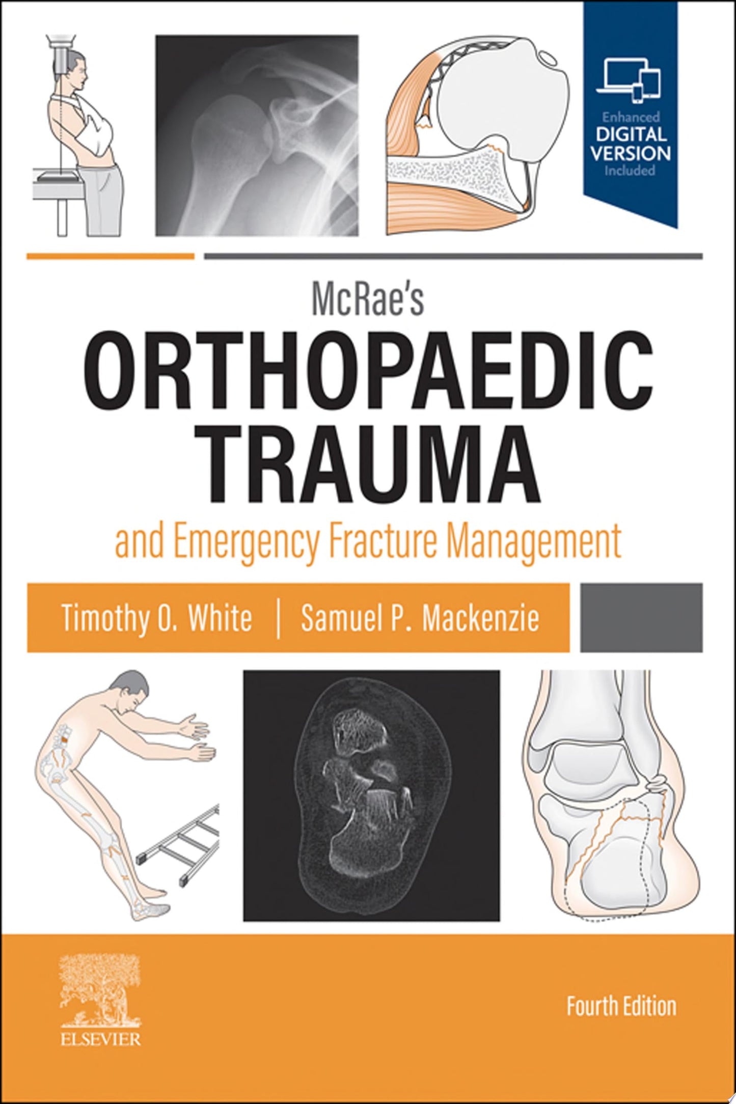 McRae’s Orthopaedic Trauma and Emergency Fracture Management, 3rd Edition