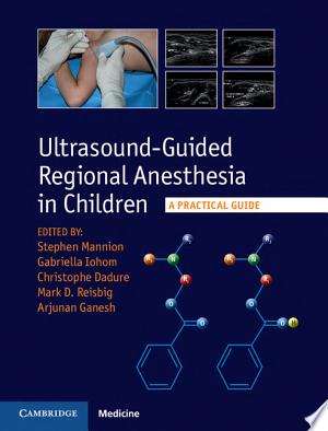 Ultrasound-Guided Regional Anesthesia in Children: A Practical Guide