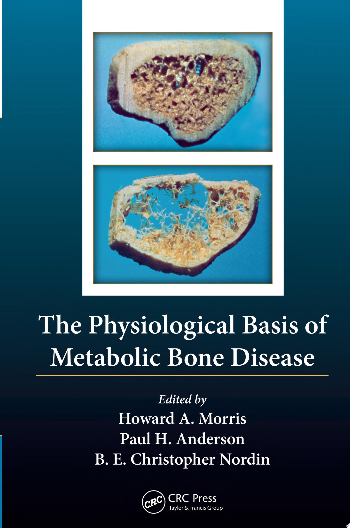 The Physiological Basis of Metabolic Bone Disease