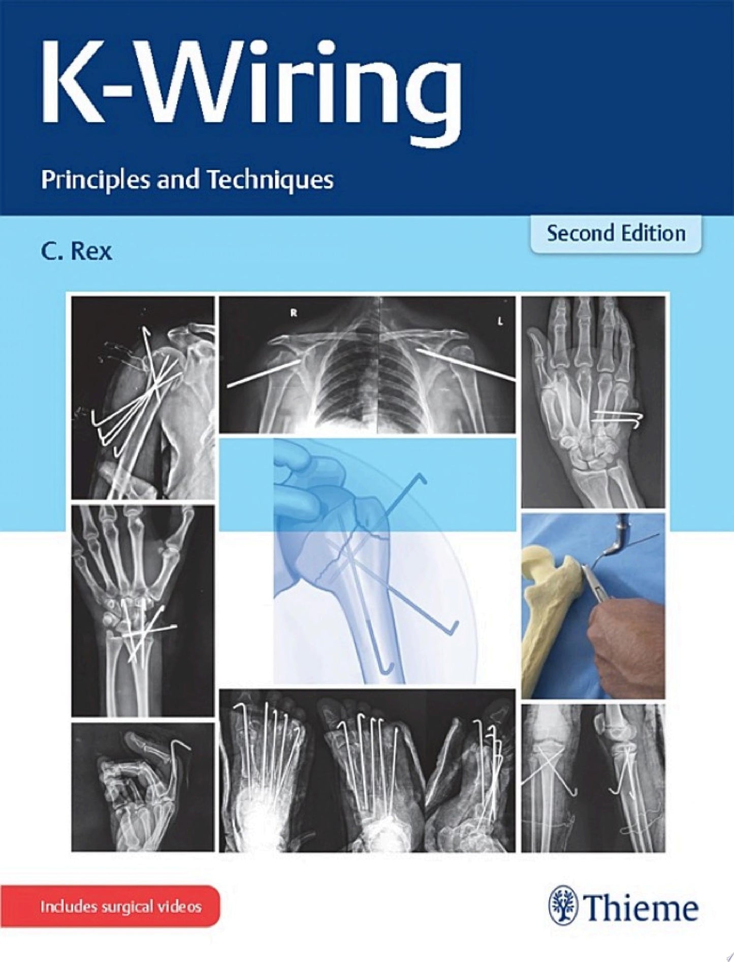 K-Wiring: Principles and Techniques, 2nd edition (PDF + Videos)