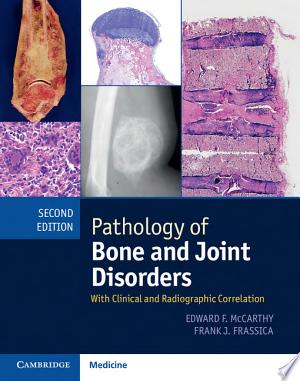 Bone and Joint Disorders 2nd Edition