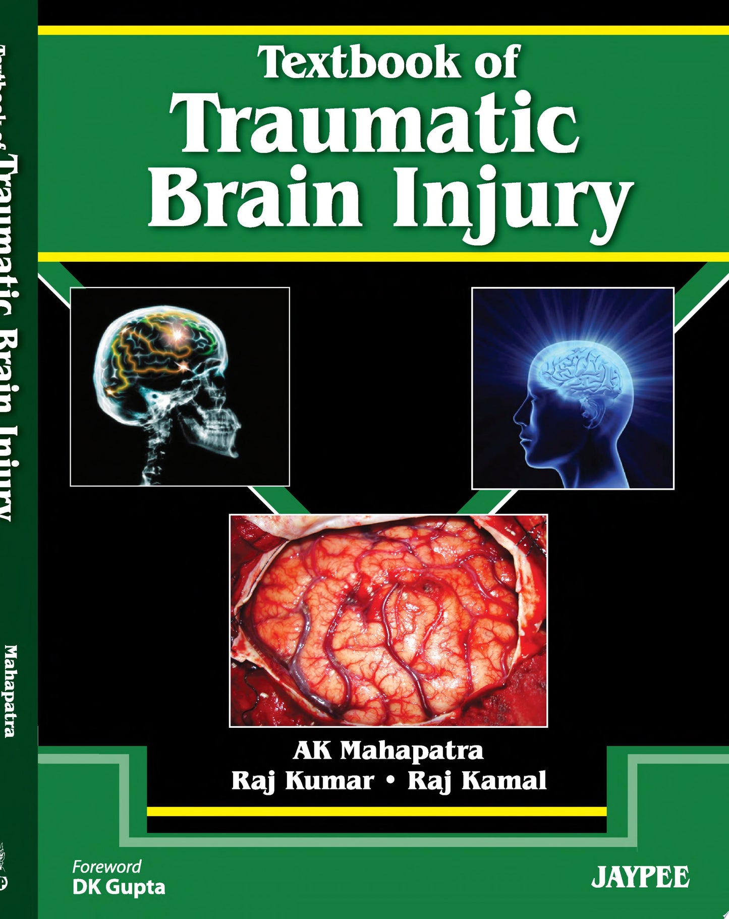 Traumatic Brain Injury