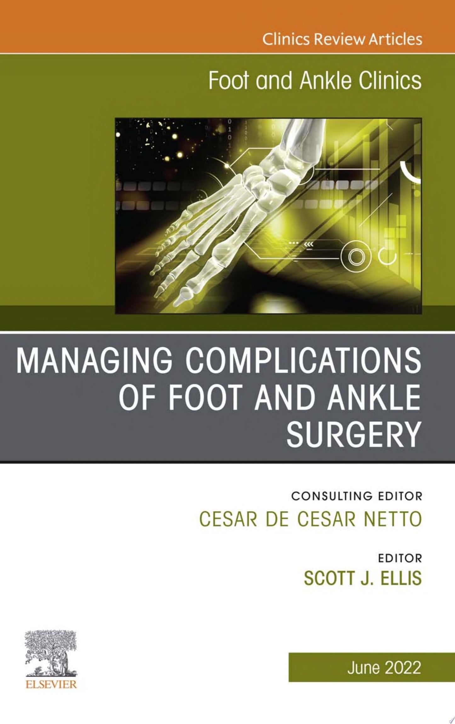 Varus Foot, Ankle, and Tibia, An Issue of Foot and Ankle Clinics, 1th edition