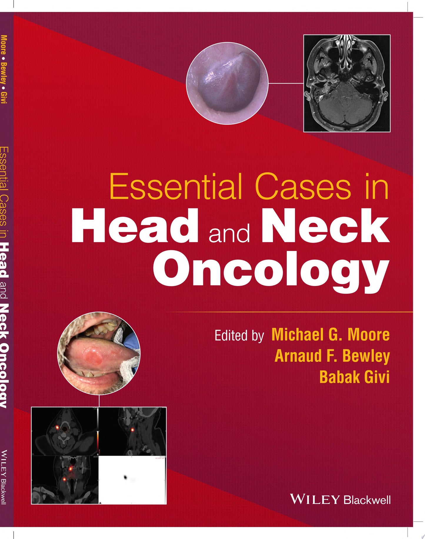 Essential Cases in Head and Neck Oncology
