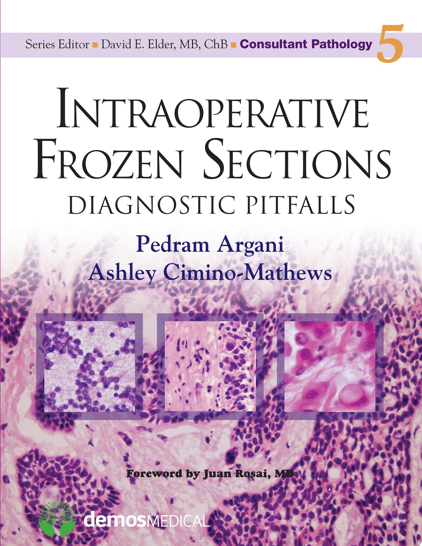 Intraoperative Frozen Sections: Diagnostic Pitfalls
