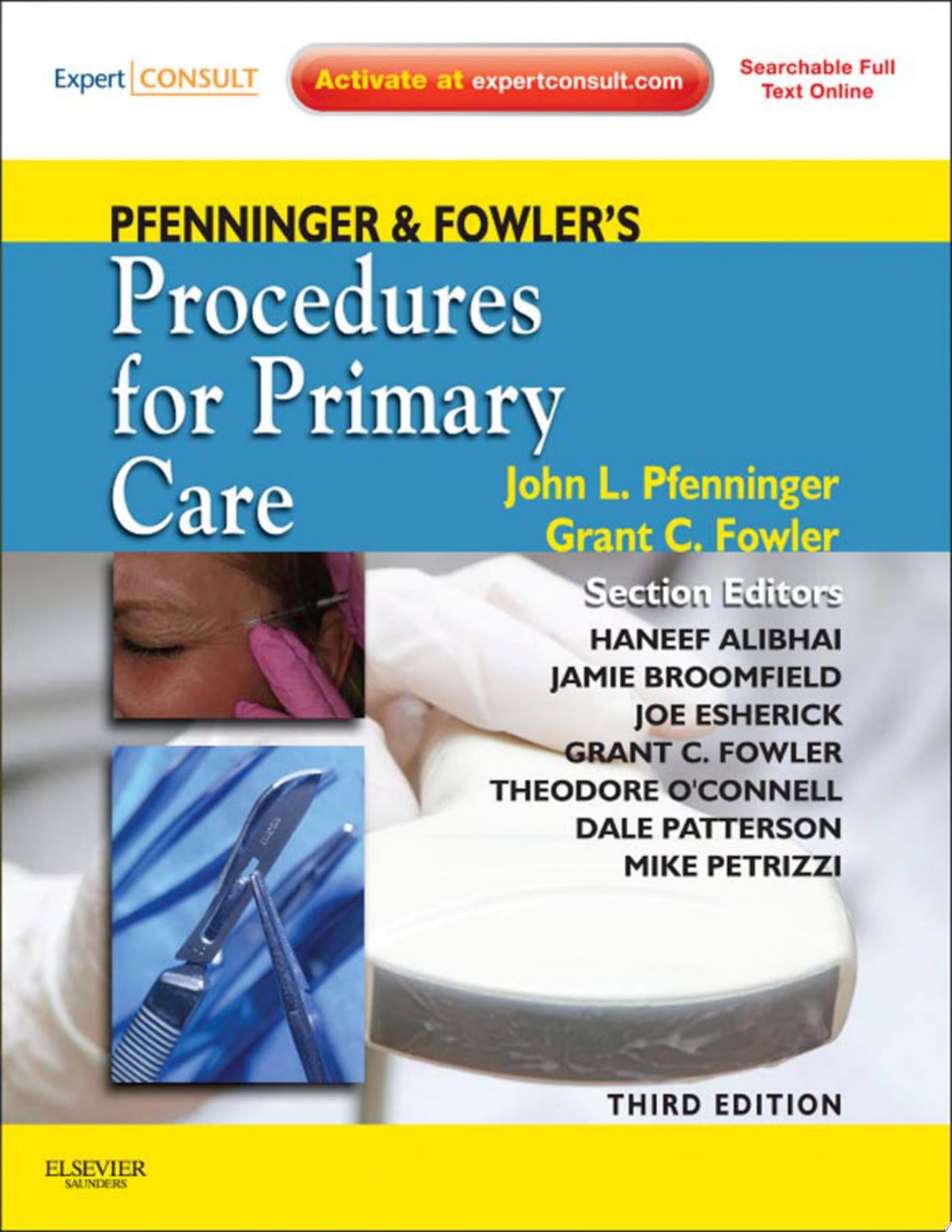 Procedures in Cosmetic Dermatology Series: Advanced Face Lifting