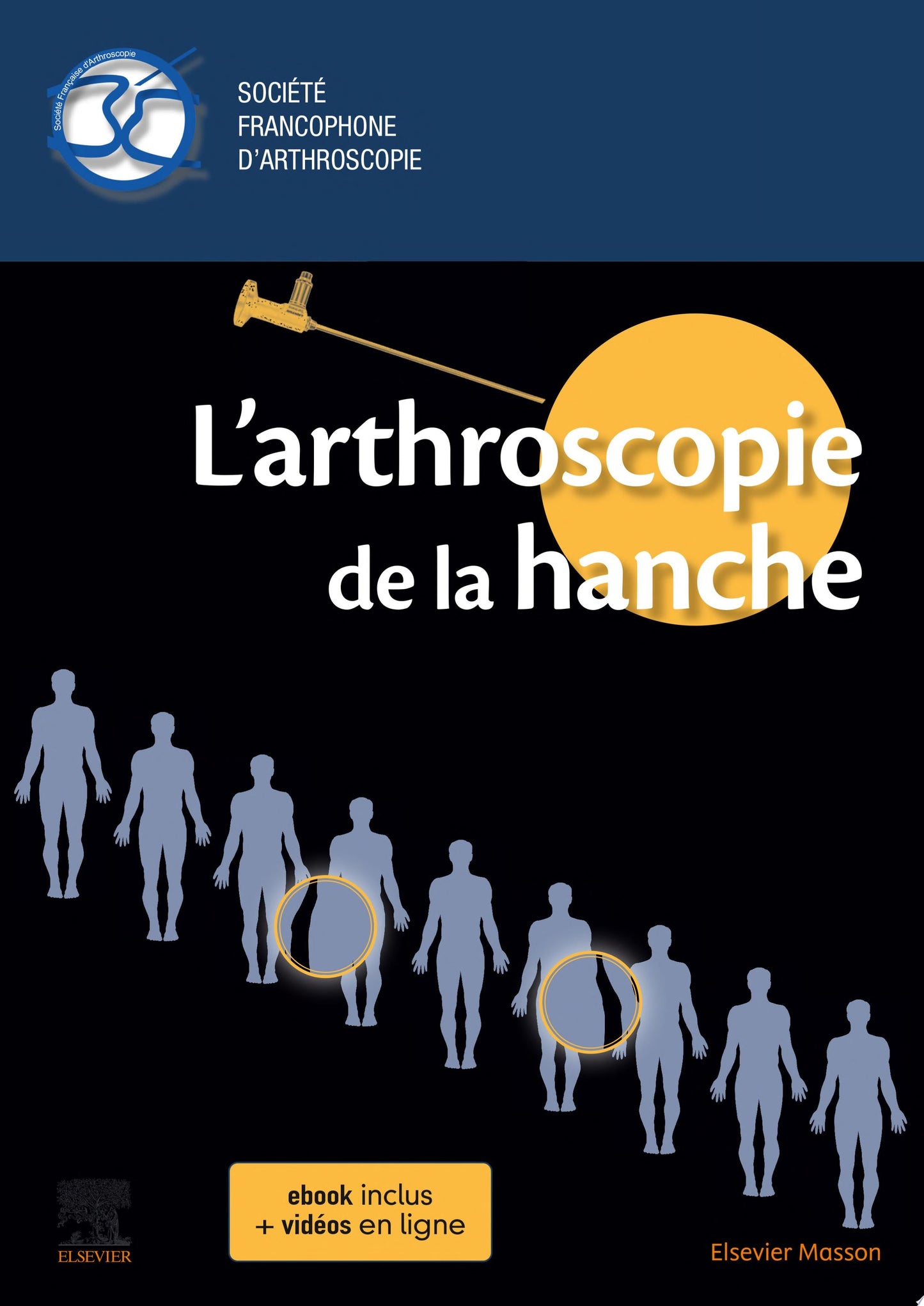 L’arthroscopie