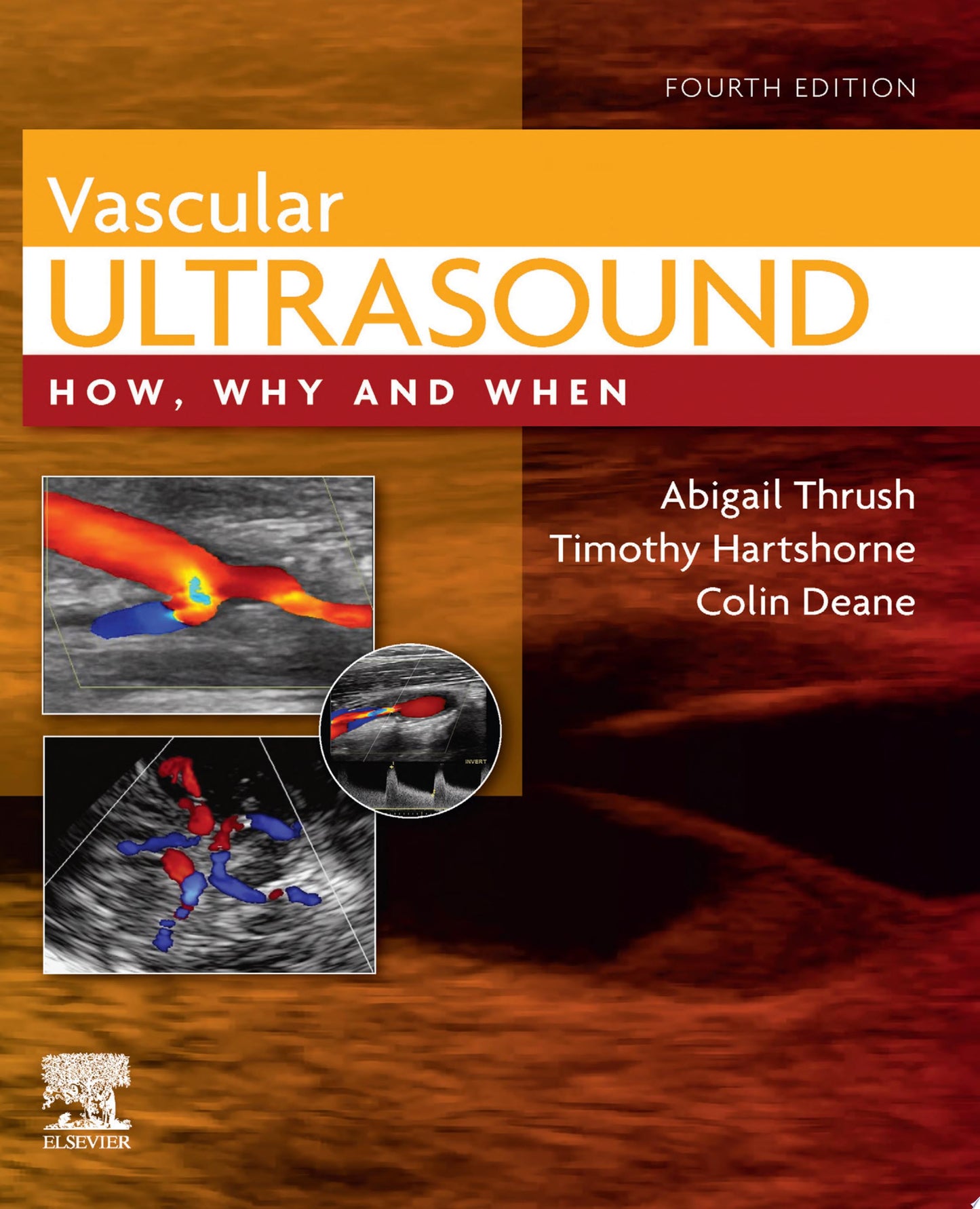 Vascular Ultrasound: How, Why and When, 4th Edition