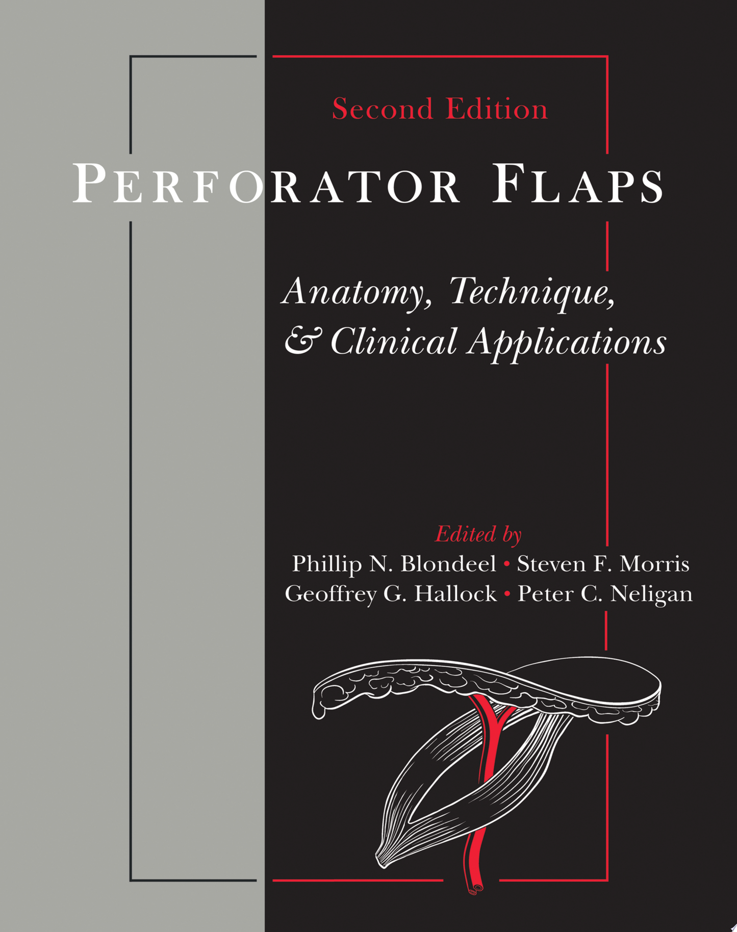Perforator Flaps: Anatomy, Technique, & Clinical Applications, Second Edition