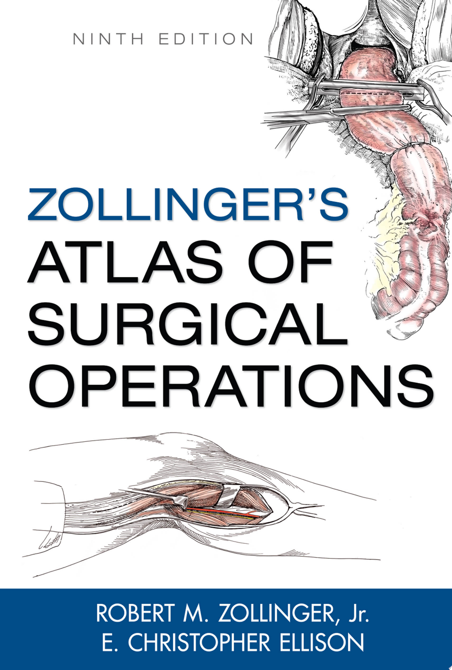 Zollinger’s Atlas of Surgical Operations, 9th Edition