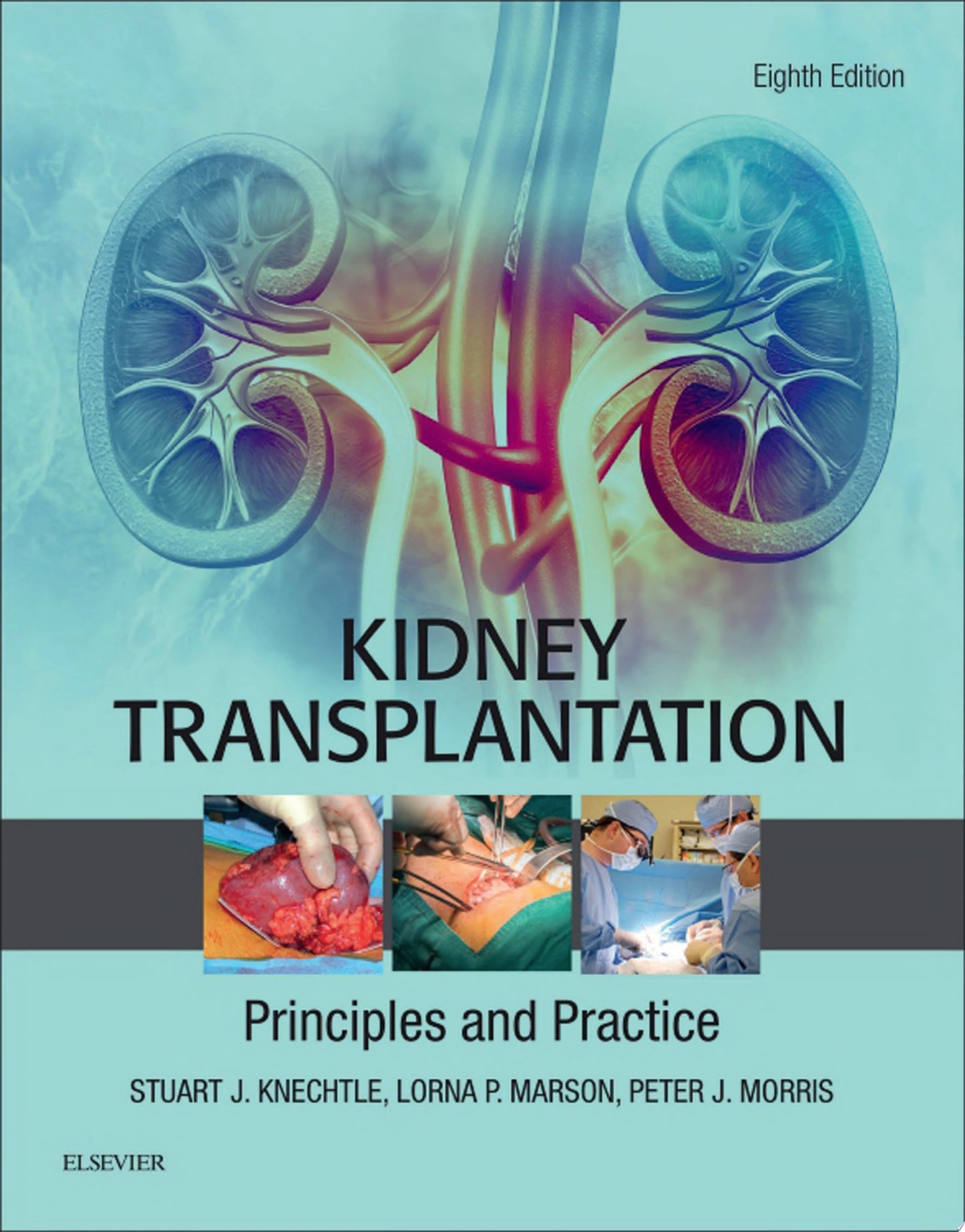 Kidney Transplantation – Principles and Practice, 7th Edition