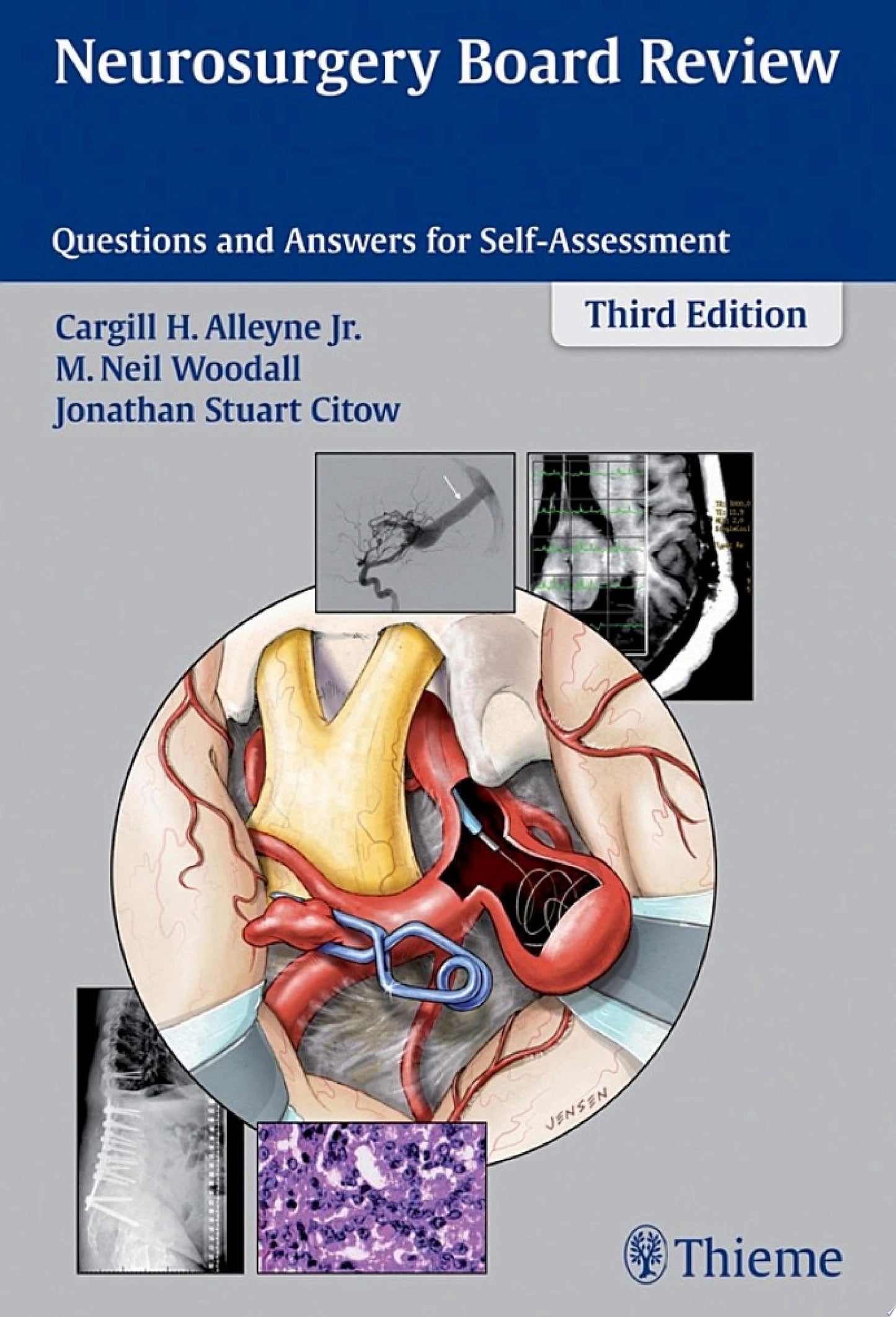 Neurosurgery Board Review: Questions and Answers for Self-Assessment, 3rd Edition