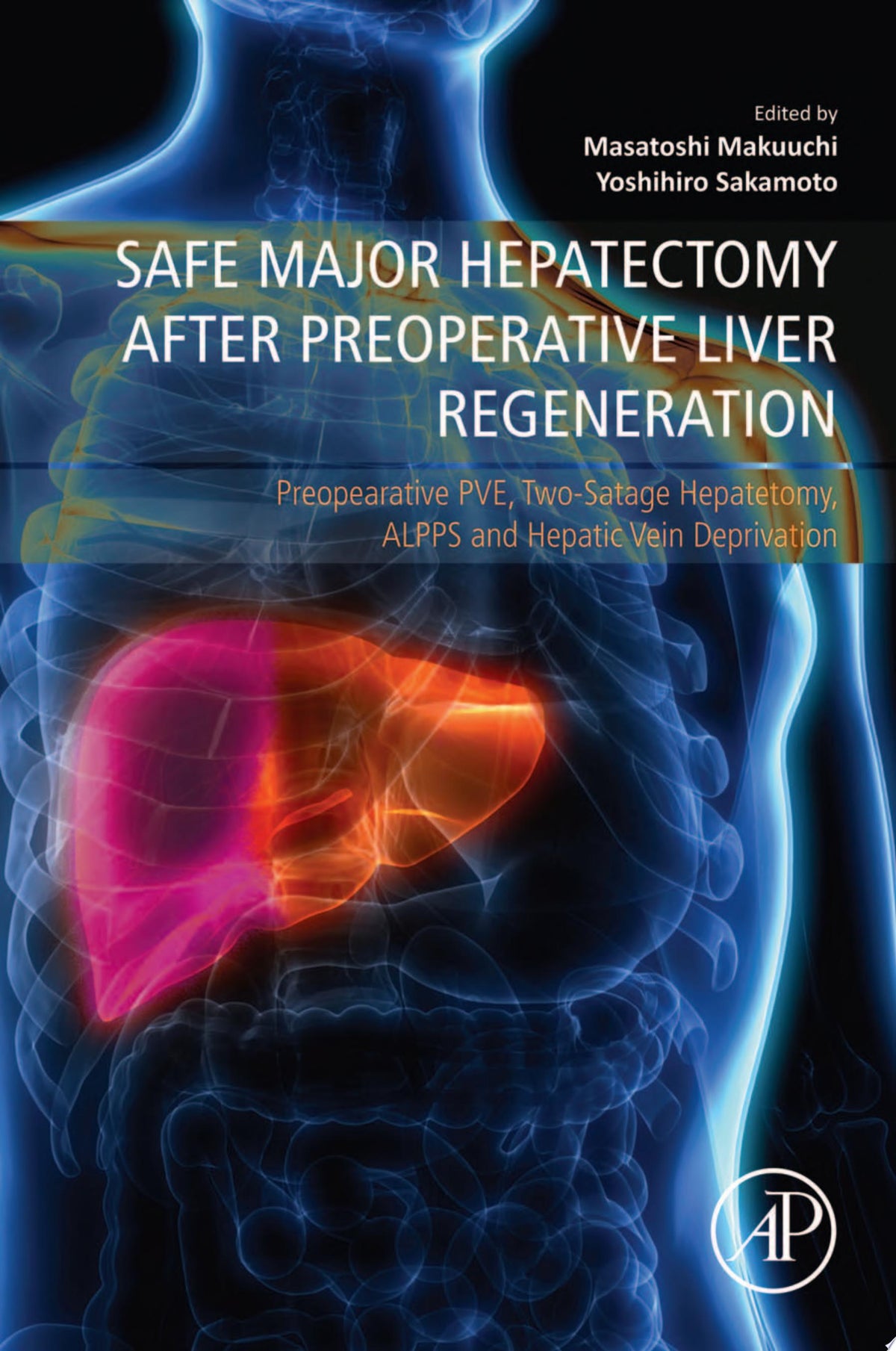 Safe Major Hepatectomy after Preoperative Liver Regeneration: Preopearative PVE, Two-Satage Hepatetomy, ALPPS and Hepatic Vein Deprivation