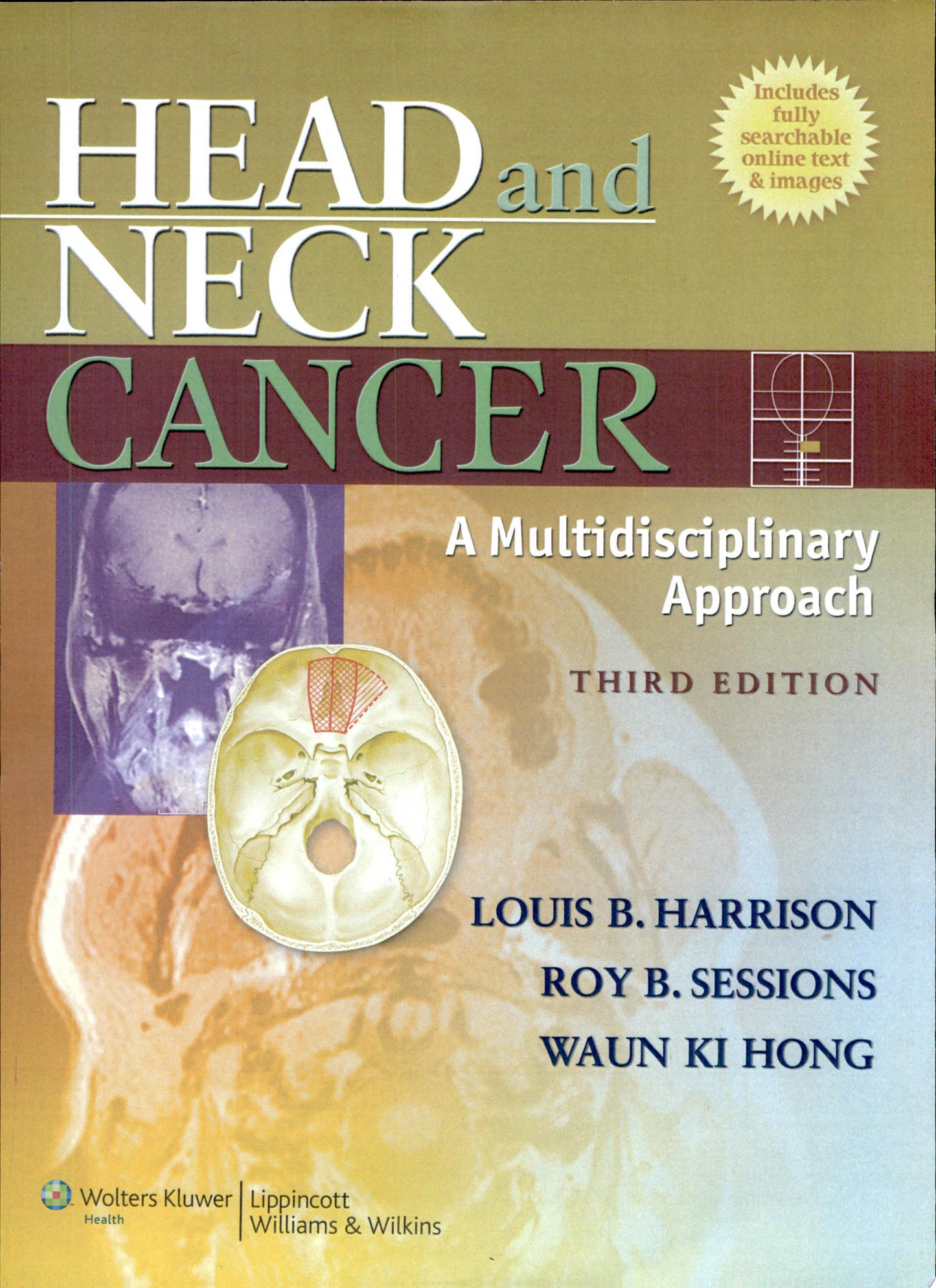 Head and Neck Cancer: A Multidisciplinary Approach, 4th Edition