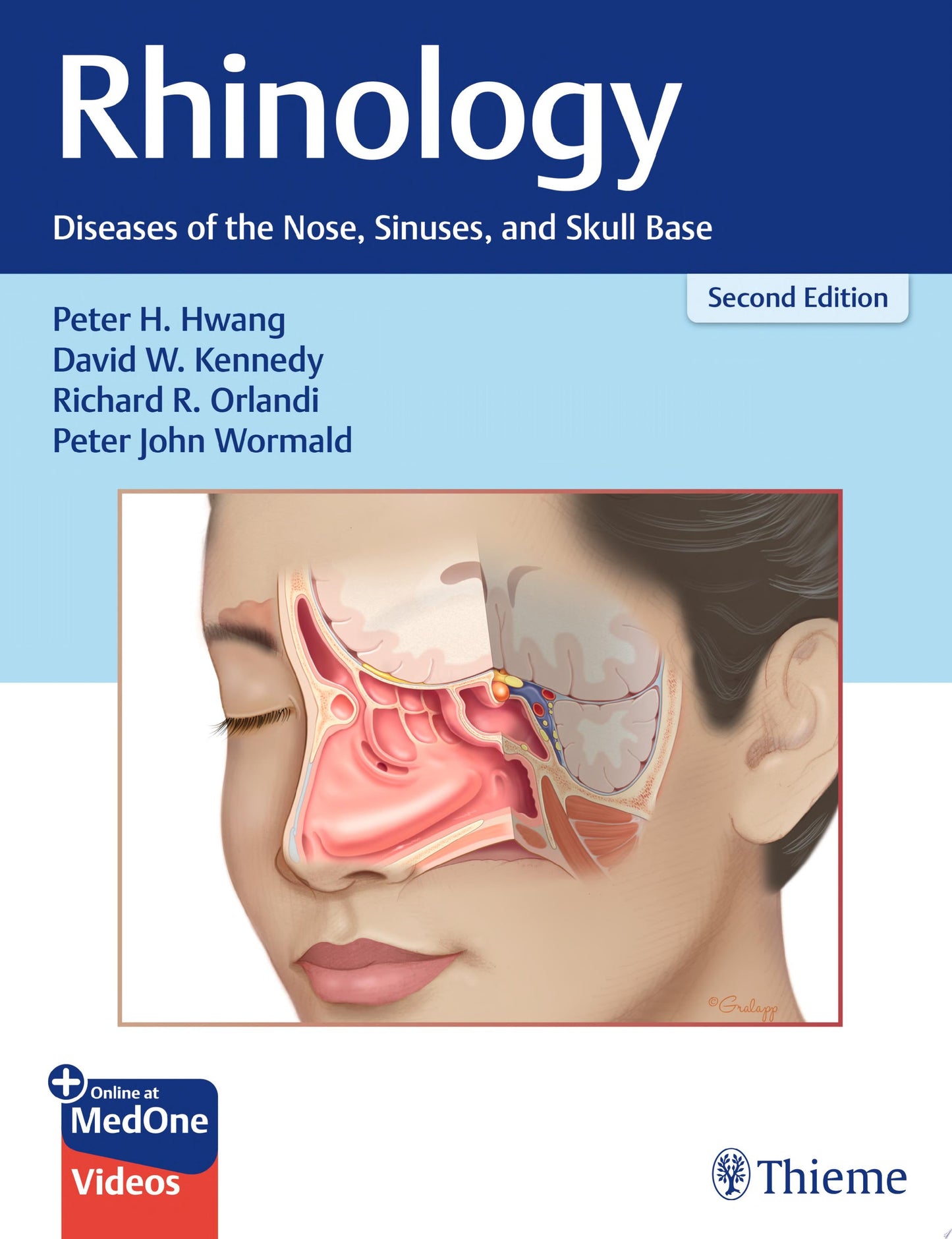 Rhinology: Diseases of the Nose, Sinuses, and Skull Base 2e