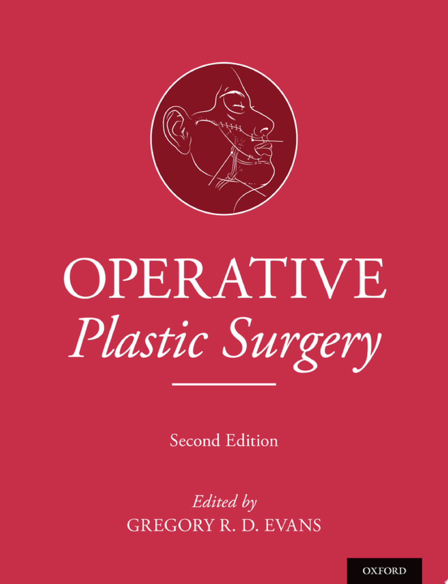 Operative Plastic Surgery 2nd