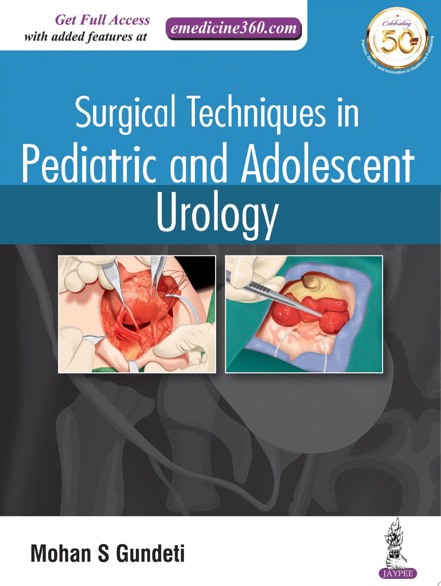 Surgical Techniques in Pediatric and Adolescent Urology