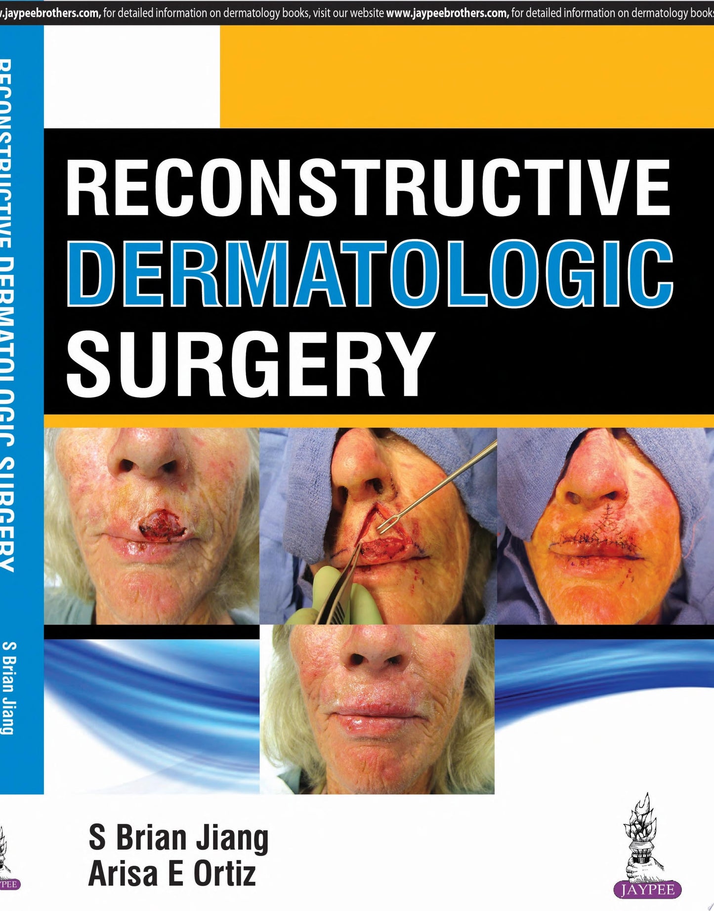 Dermatologic Surgery, 2nd Edition