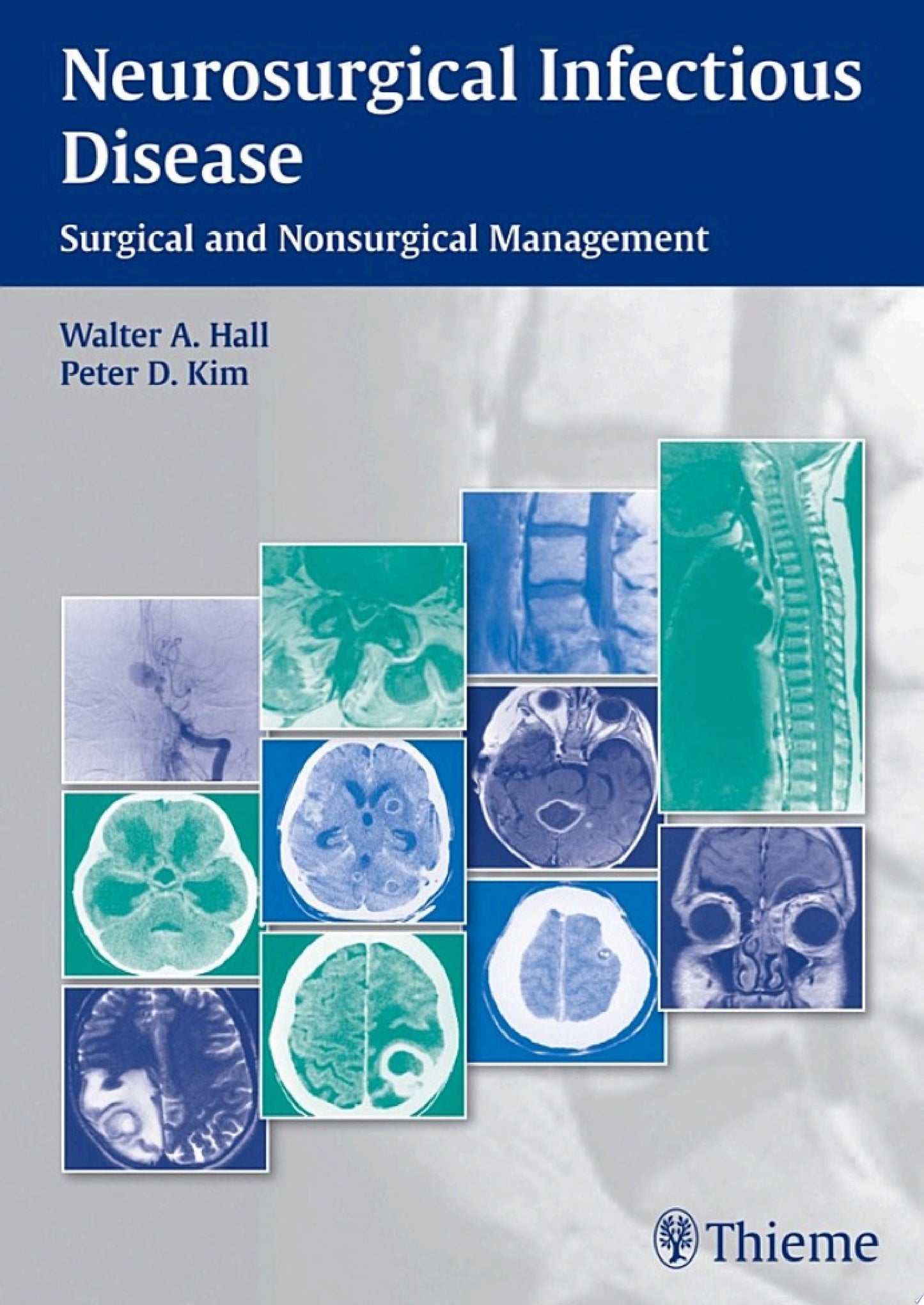 Neurosurgical Infectious Disease: Surgical and Nonsurgical Management