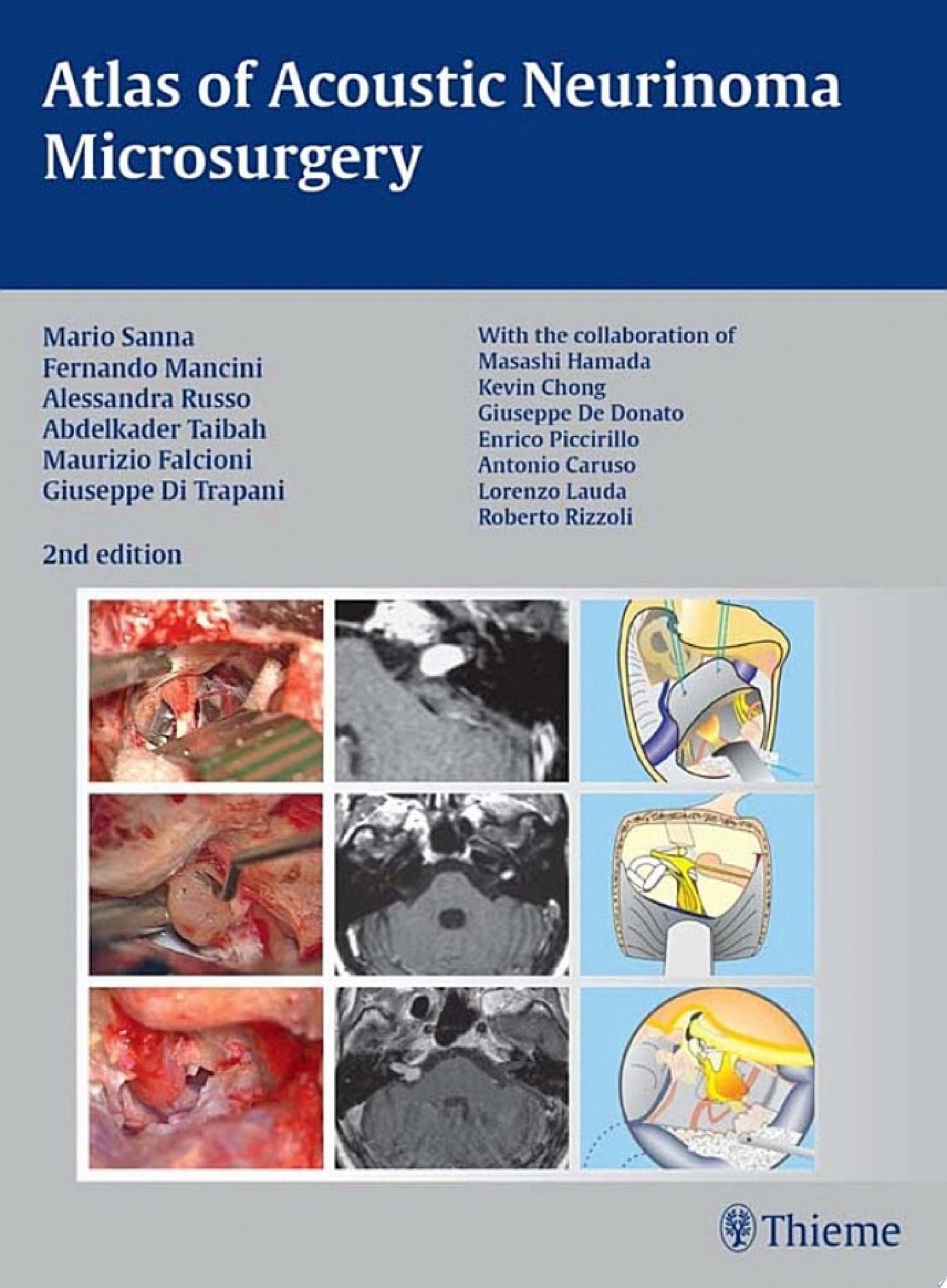 Atlas of Acoustic Neurinoma Microsurgery, 2nd Edition
