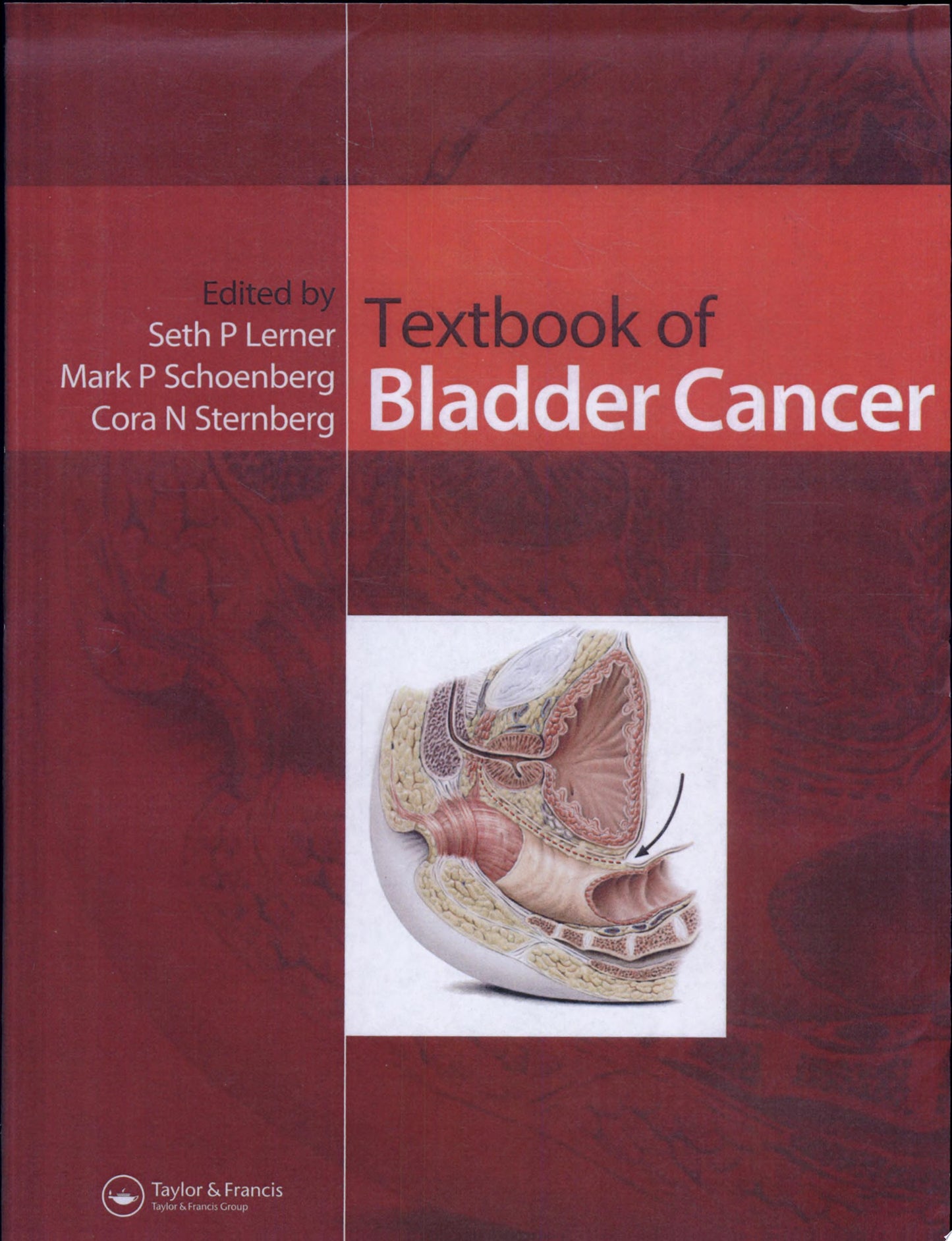 Textbook of Bladder Cancer
