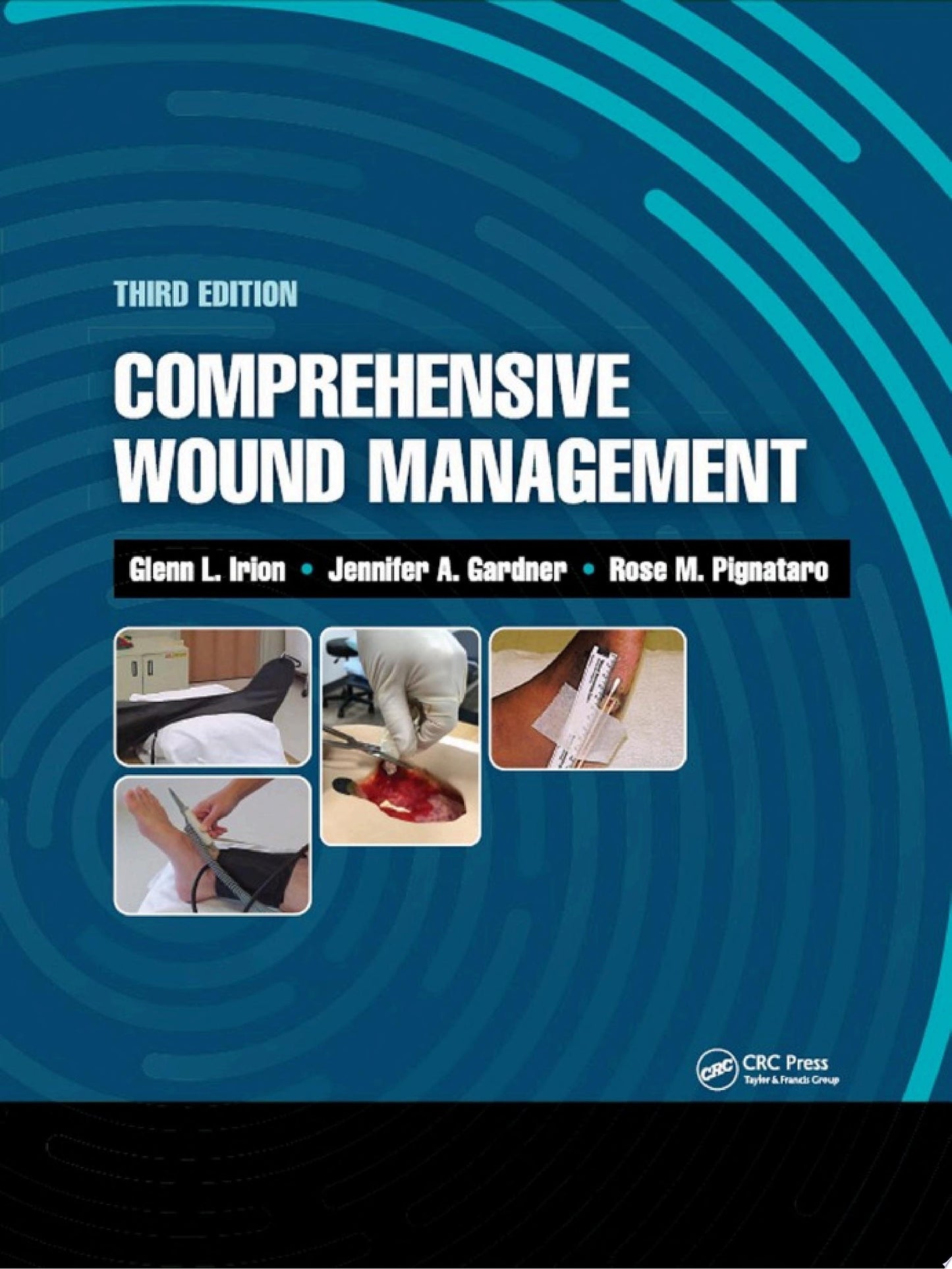 Comprehensive Wound Management, 3rd Edition