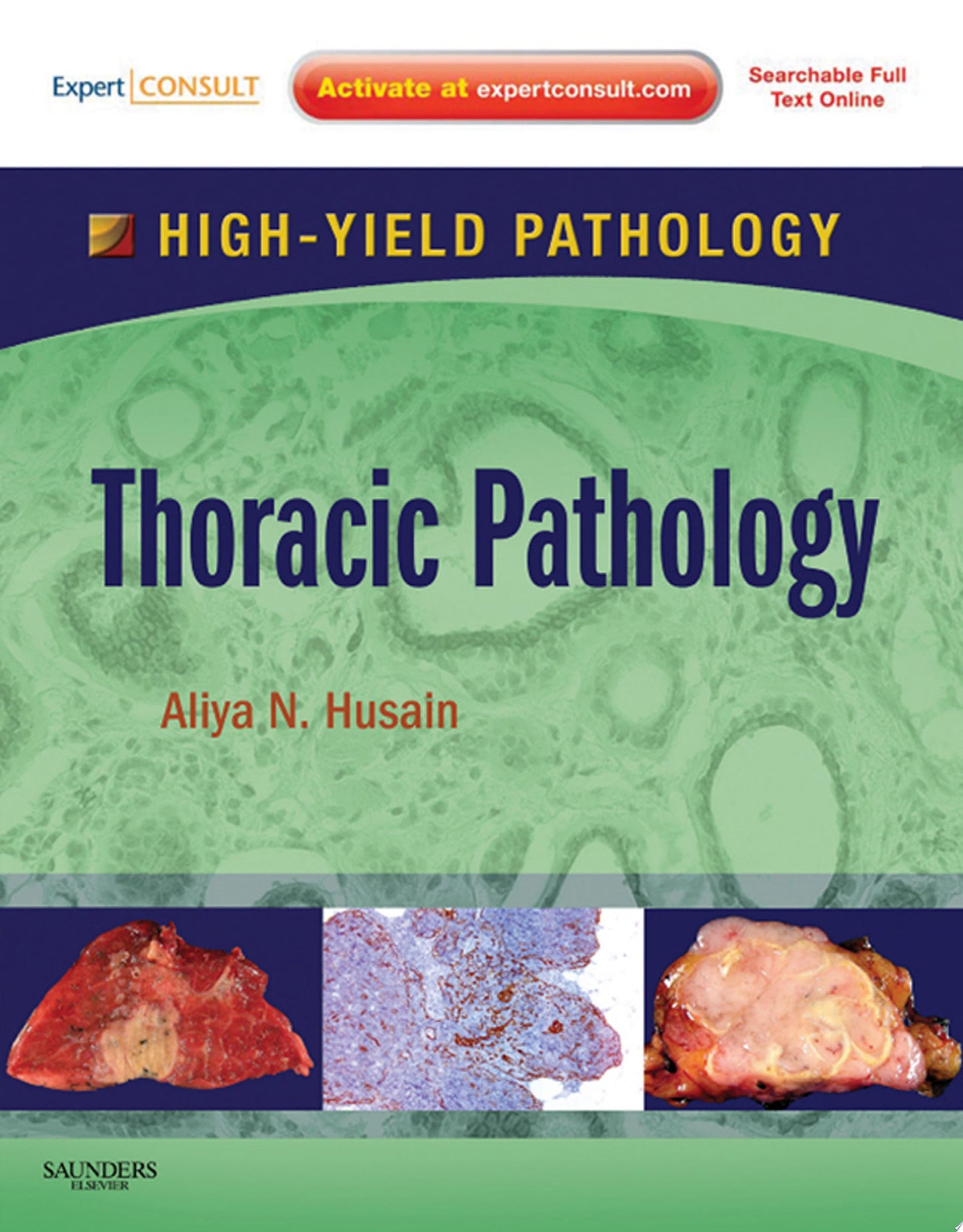 Uropathology: A Volume in the High Yield Pathology Series