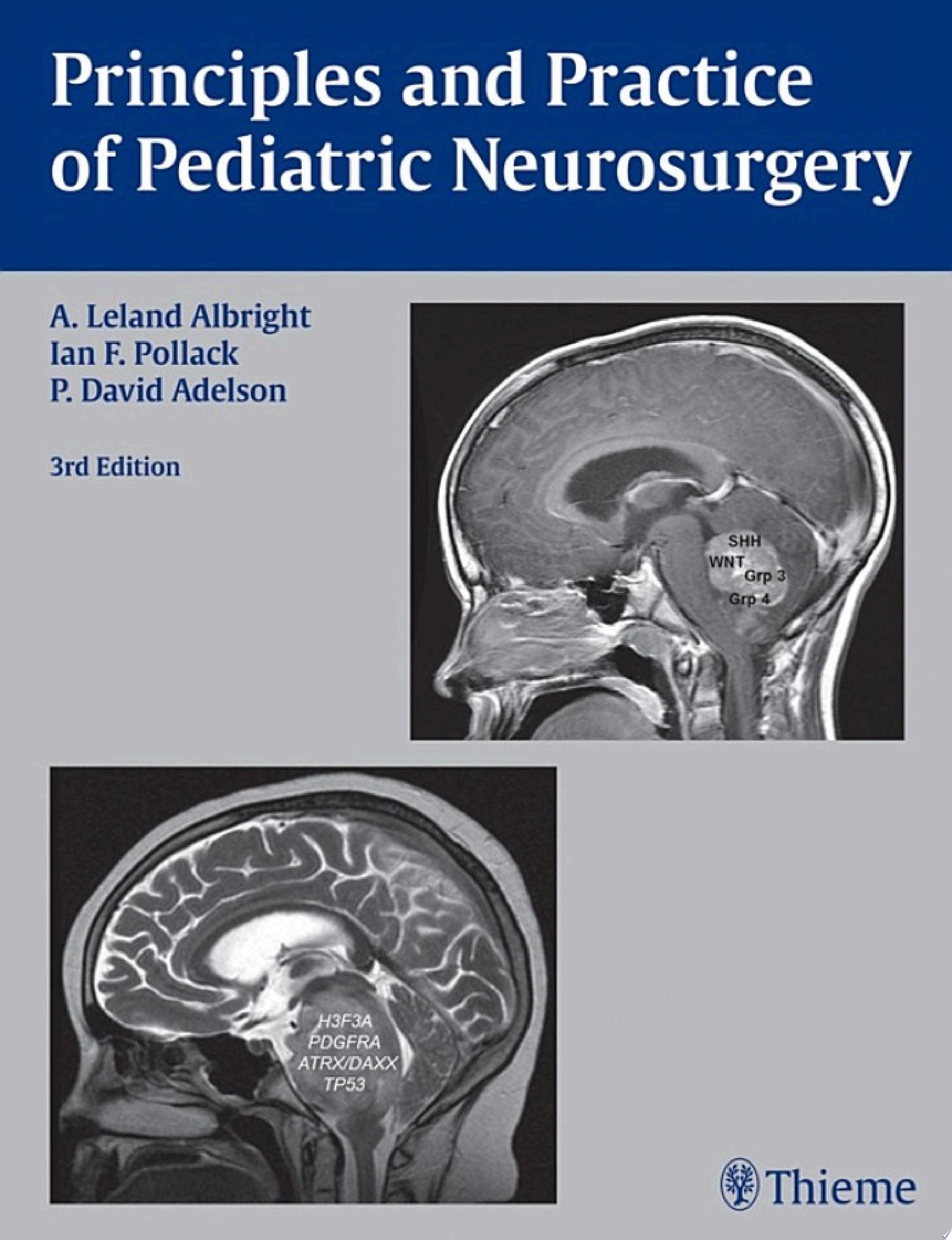 Pediatric Neurosurgery , 2nd Edition